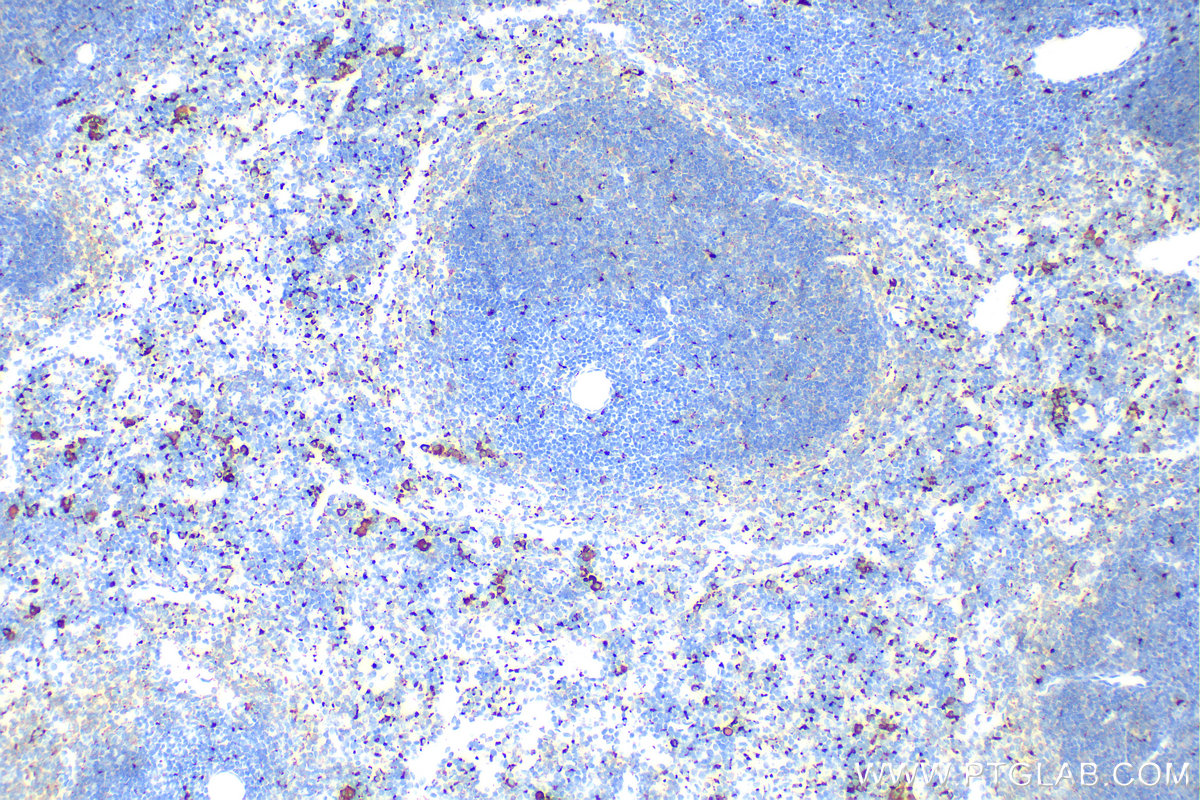 IHC staining of mouse spleen using 28058-1-AP