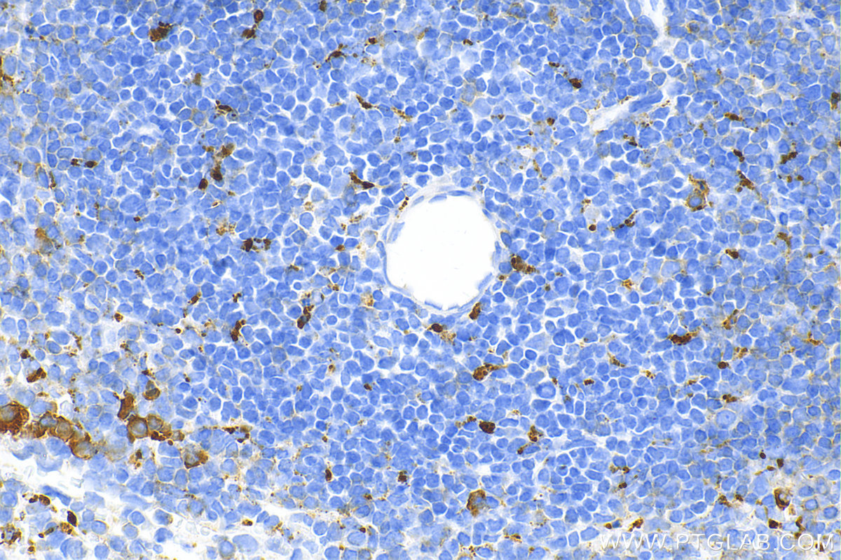 IHC staining of mouse spleen using 28058-1-AP