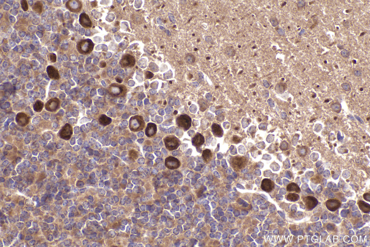 IHC staining of mouse cerebellum using 67631-1-Ig (same clone as 67631-1-PBS)