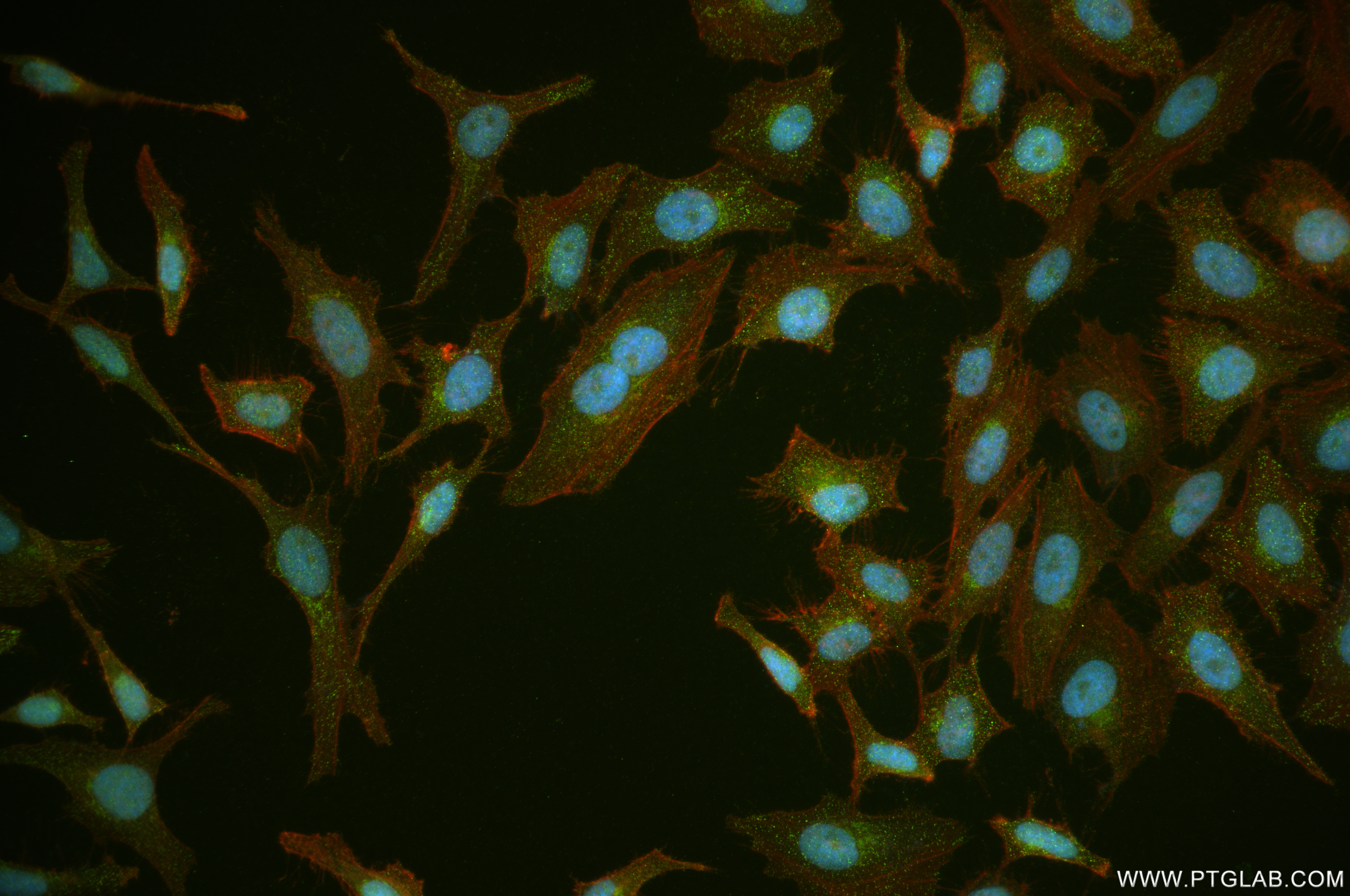 IF Staining of HeLa using 84905-1-RR