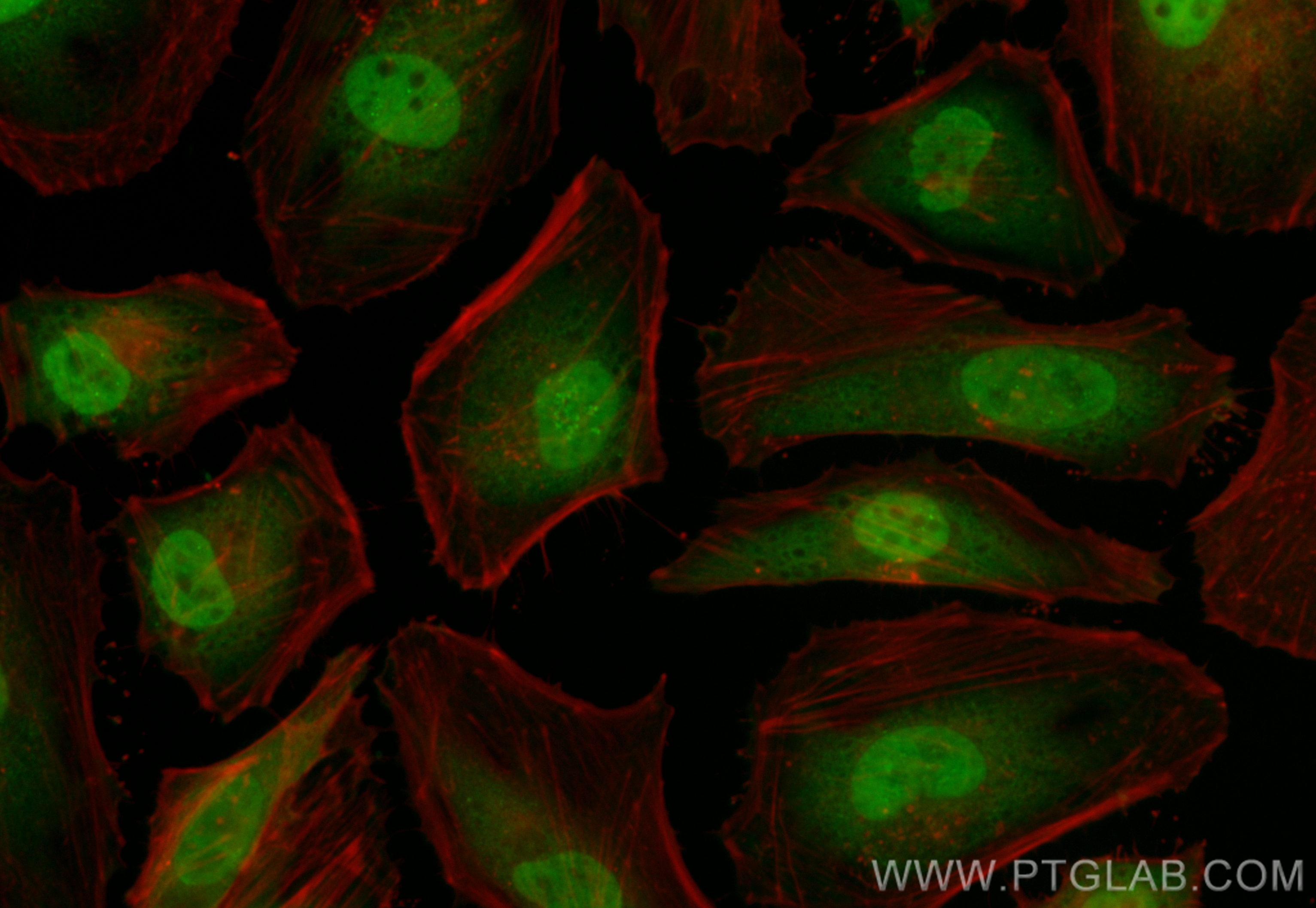 IF Staining of HeLa using CL488-80056-2