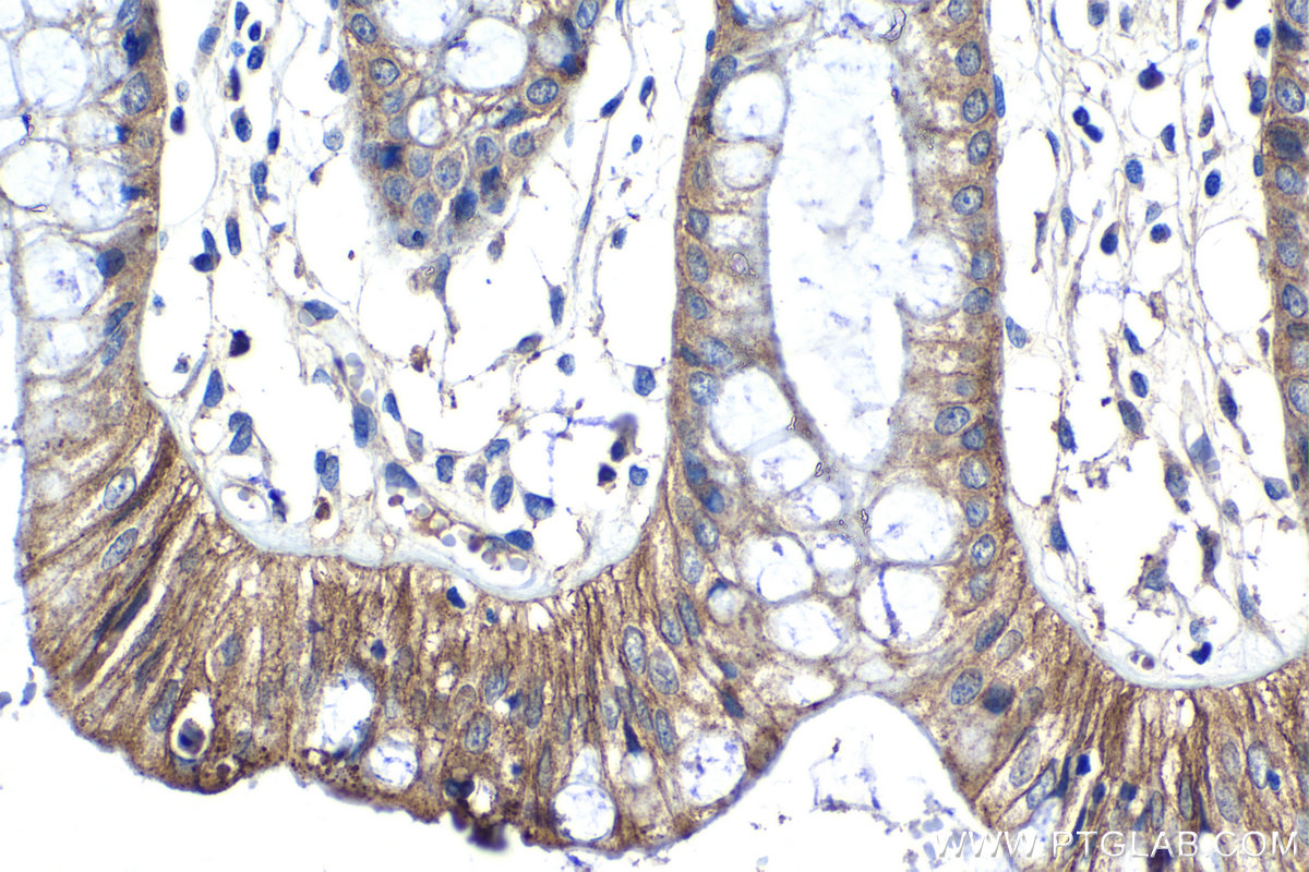 IHC staining of human colon using 29767-1-AP