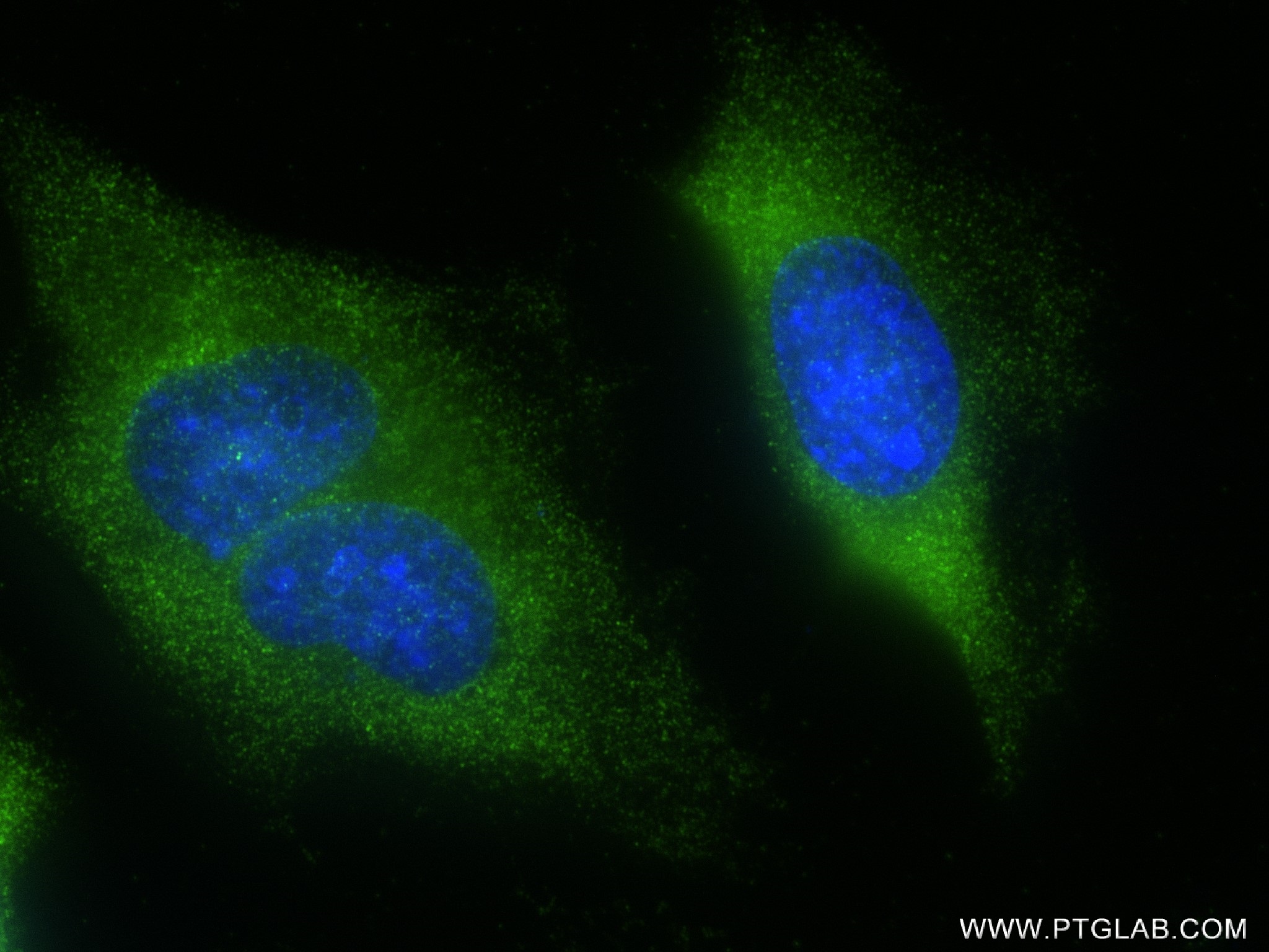 IF Staining of HeLa using 82707-13-RR