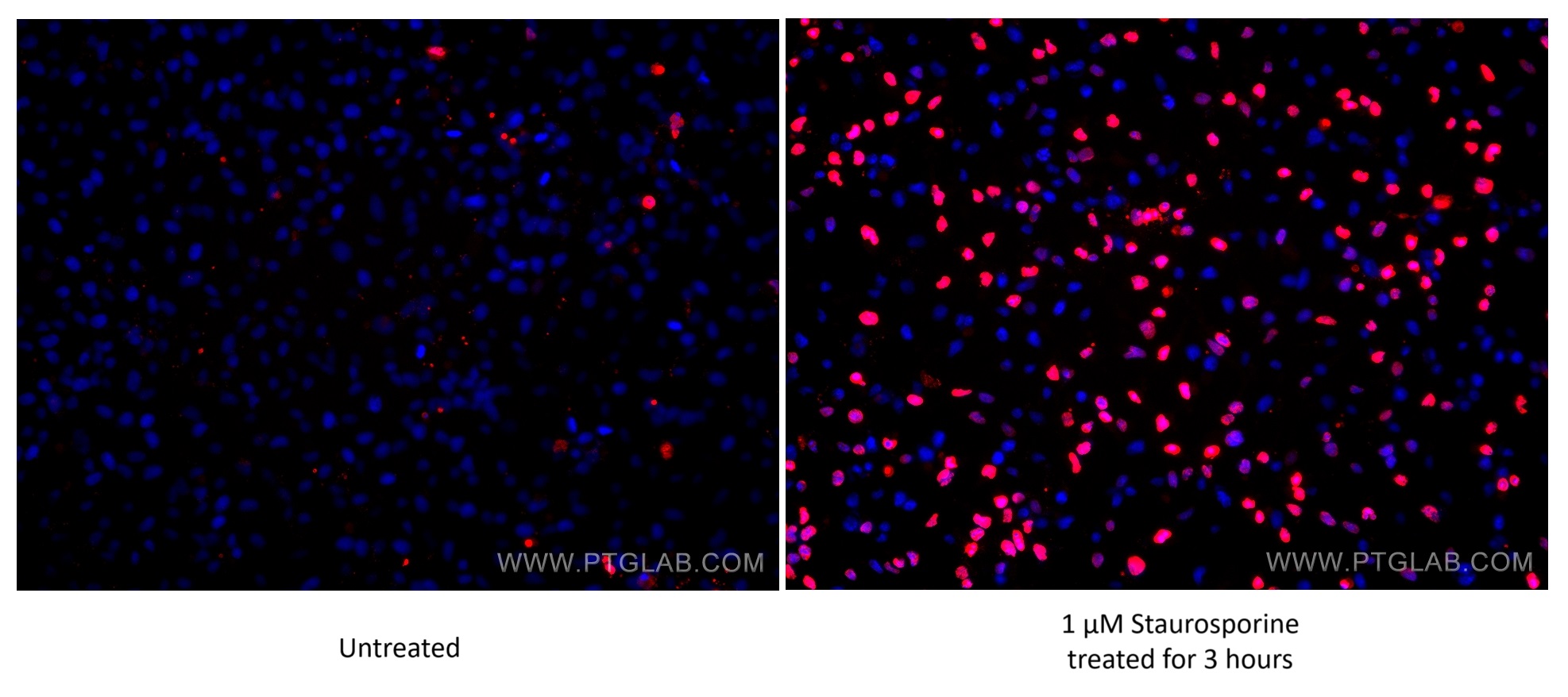 IF Staining of HeLa using 60555-1-Ig