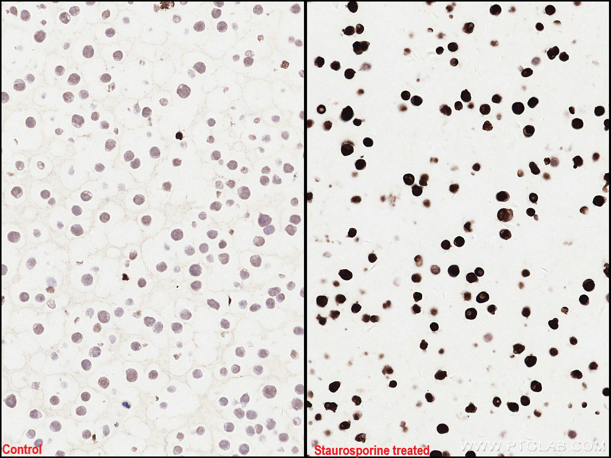 IHC staining of Jurkat using 60555-1-Ig