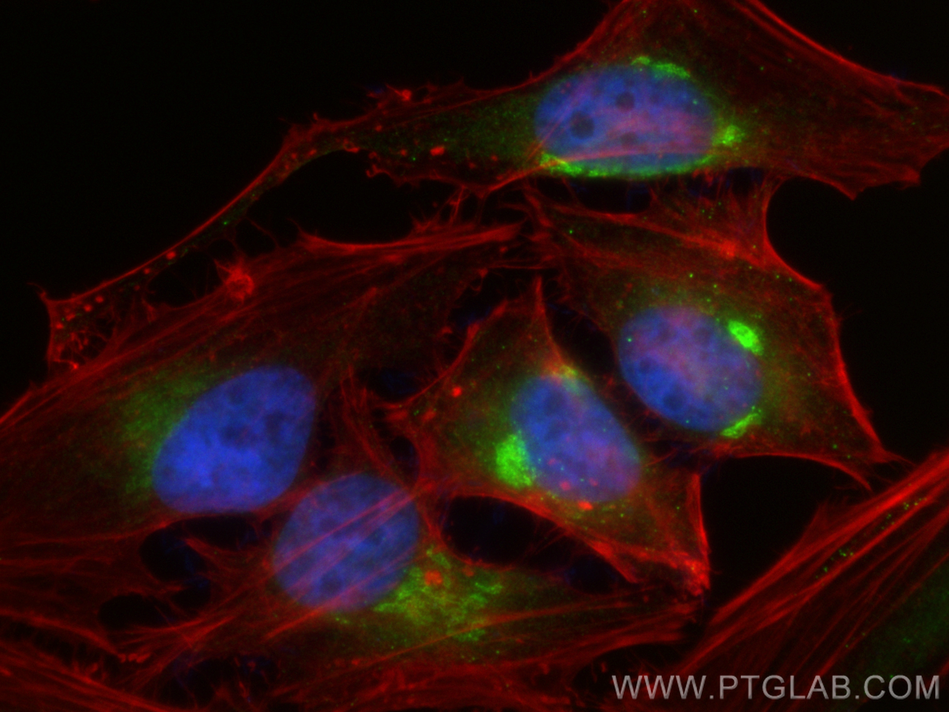 IF Staining of HeLa using 30339-1-AP