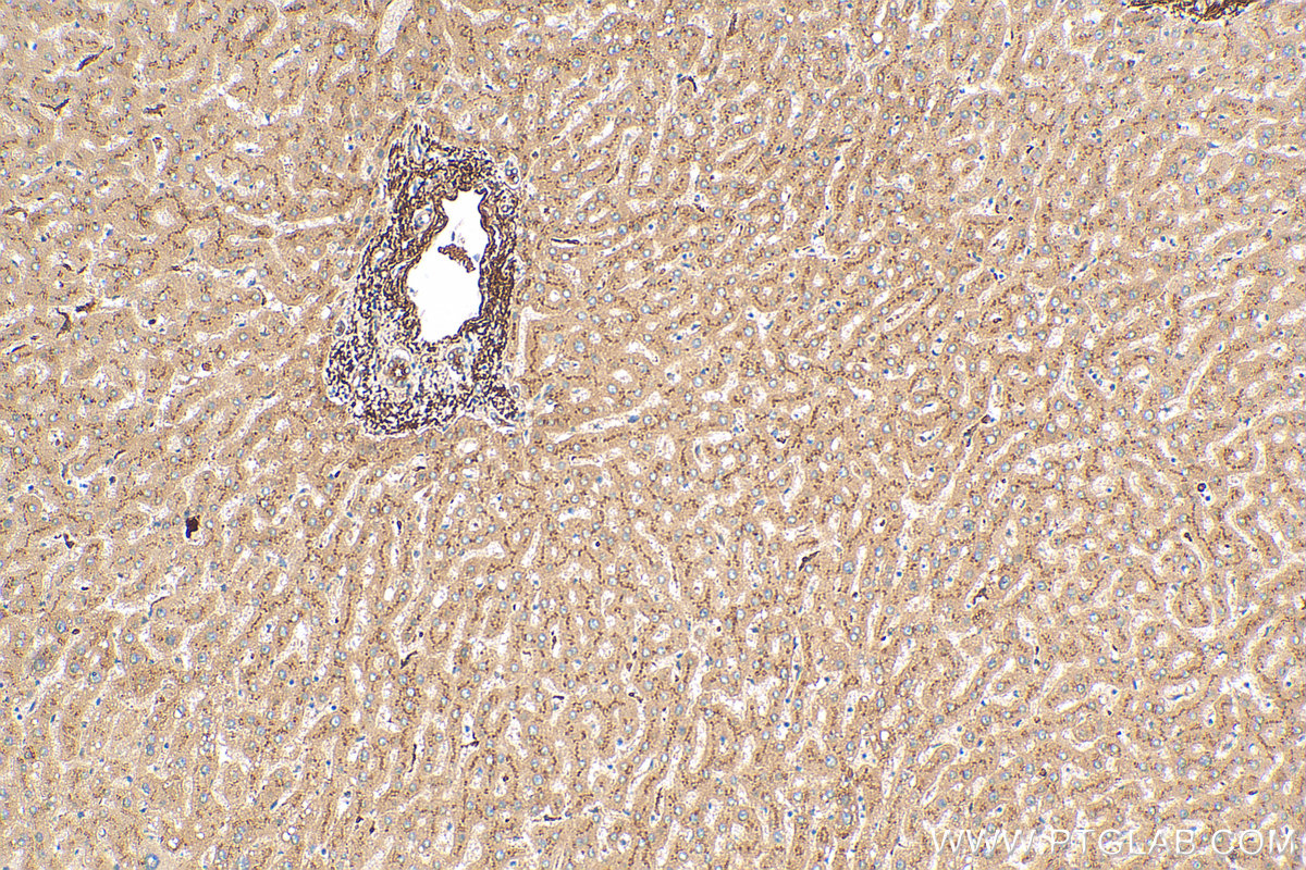 IHC staining of human liver using 30339-1-AP