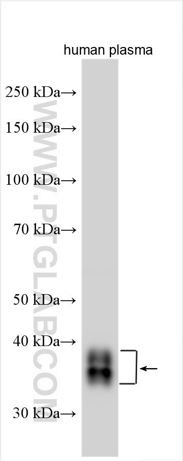 WB analysis using 30339-1-AP