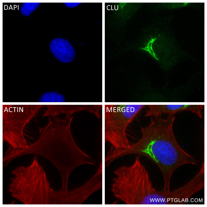 IF Staining of HeLa using 84067-4-RR