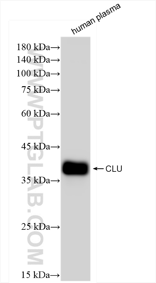 WB analysis of human plasma using 84067-4-RR