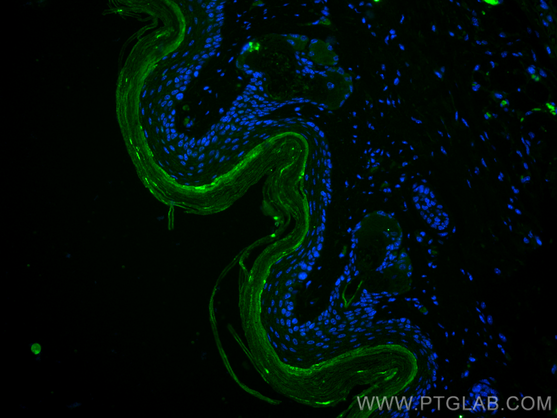 IF Staining of mouse skin using CL488-67288