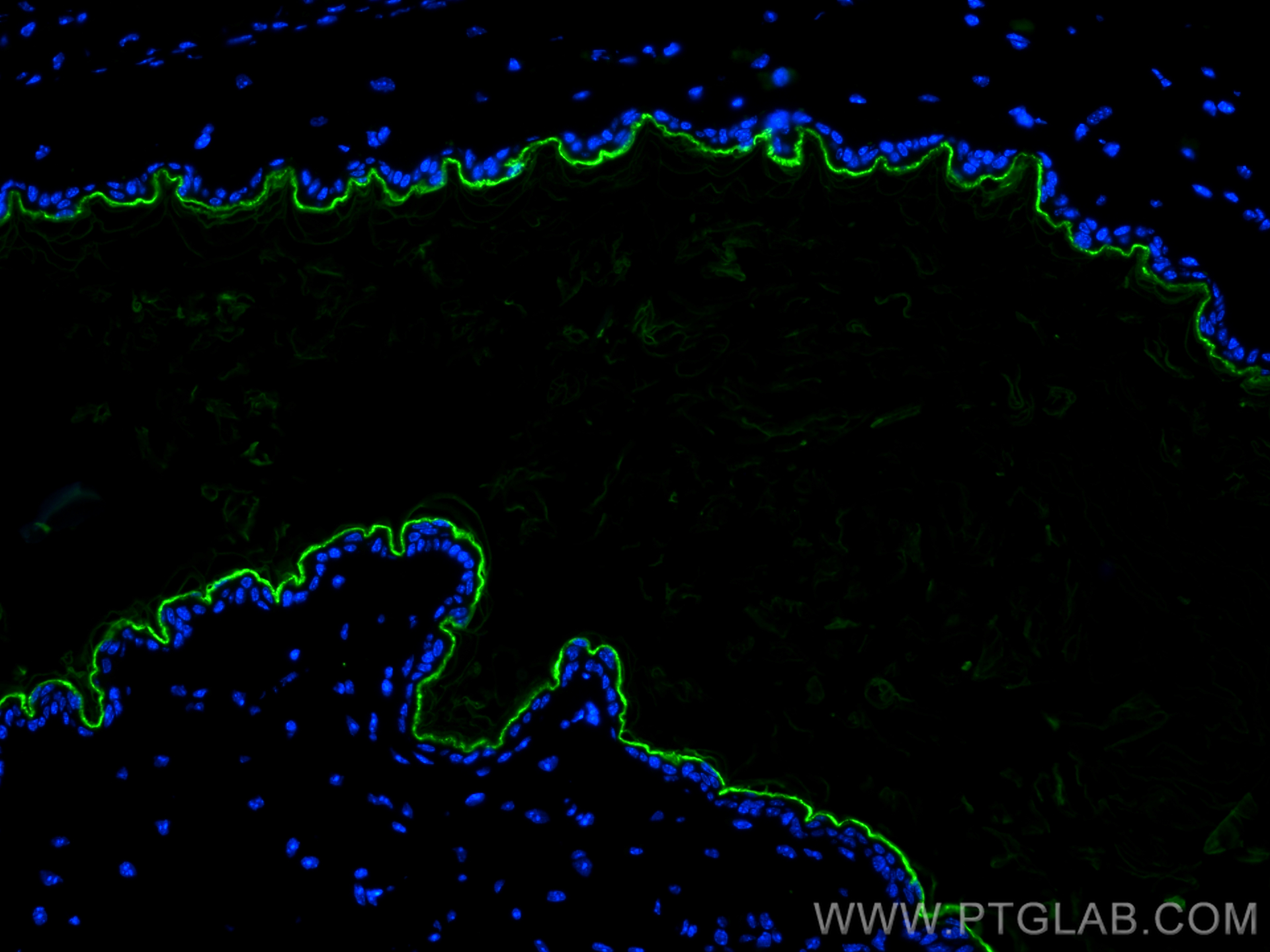 IF Staining of mouse skin using CL488-67288