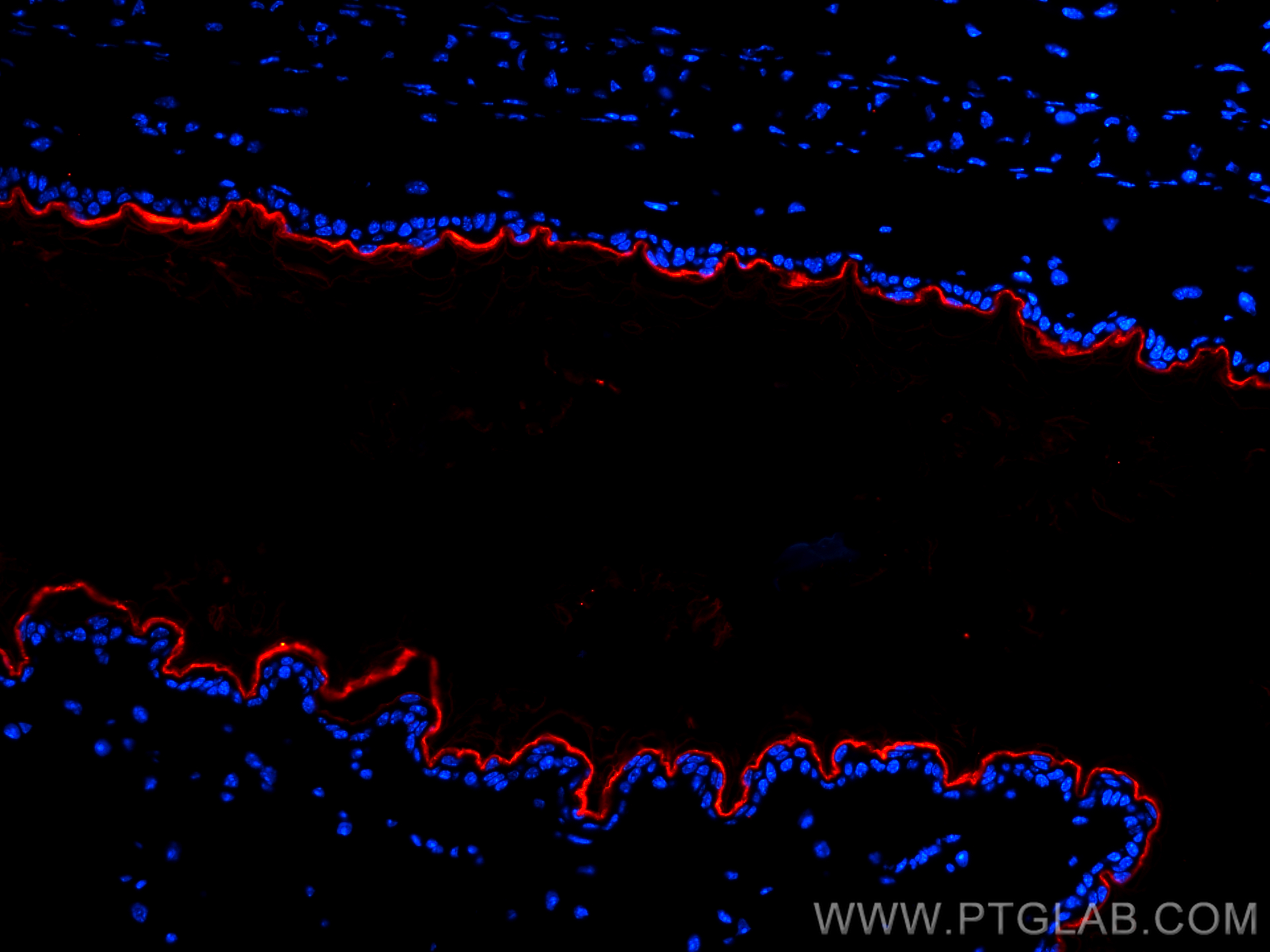 IF Staining of mouse skin using CL594-67288