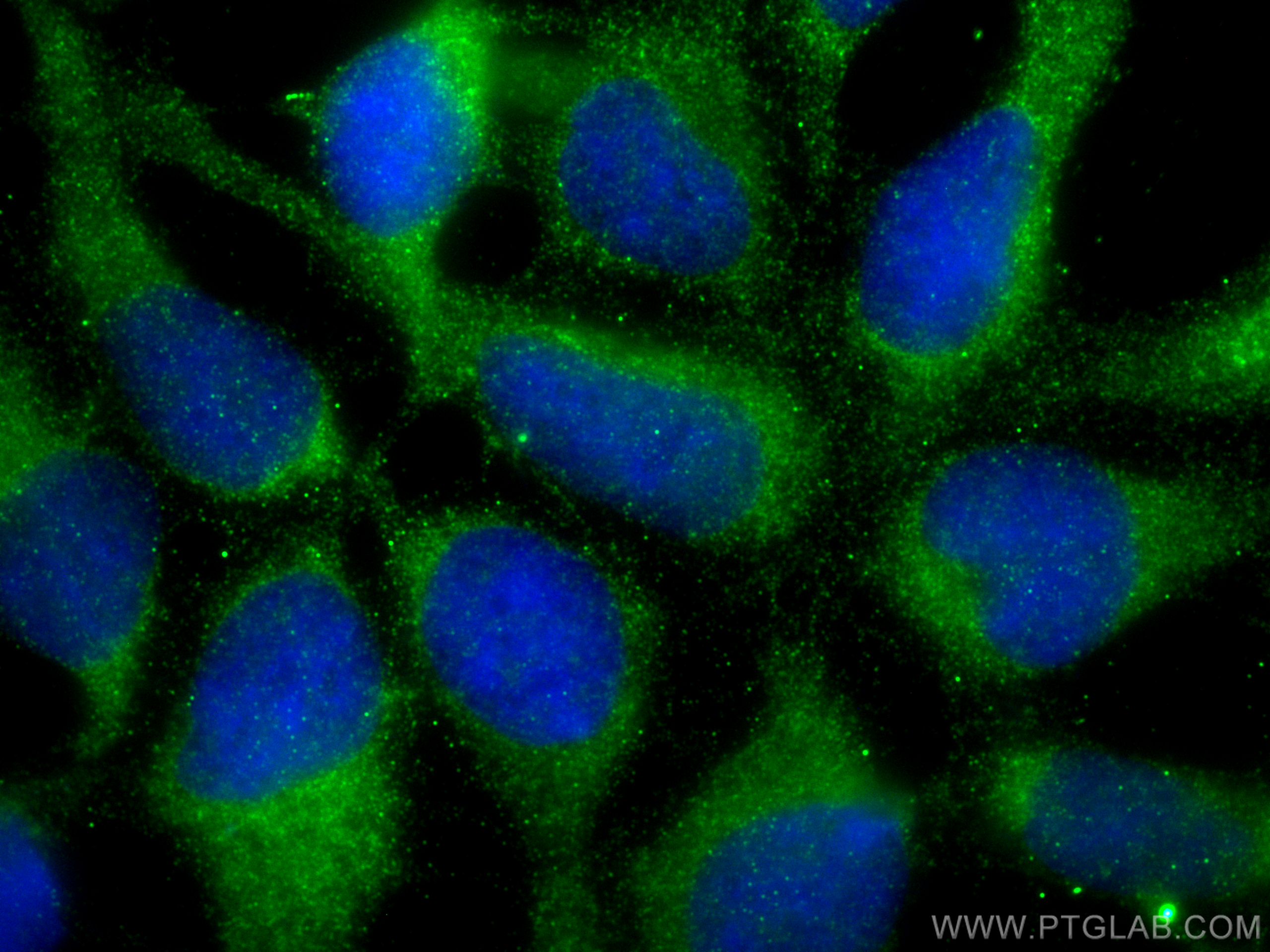 IF Staining of HEK-293 using 28459-1-AP