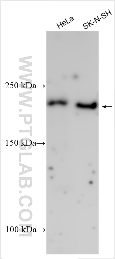 Collagen Type IV