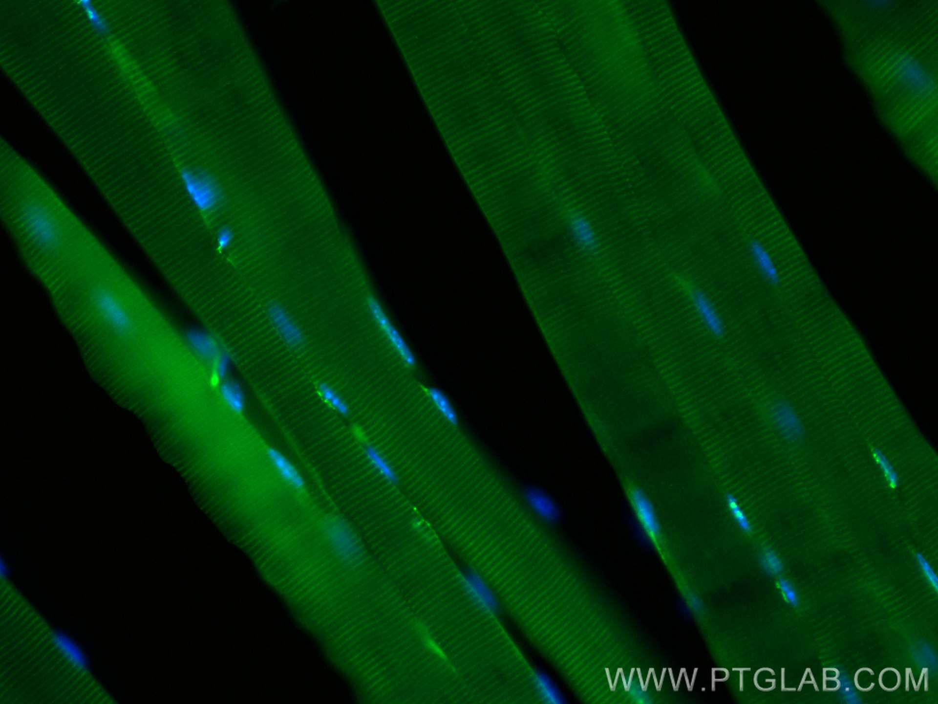 IF Staining of mouse skeletal muscle using CL488-17023