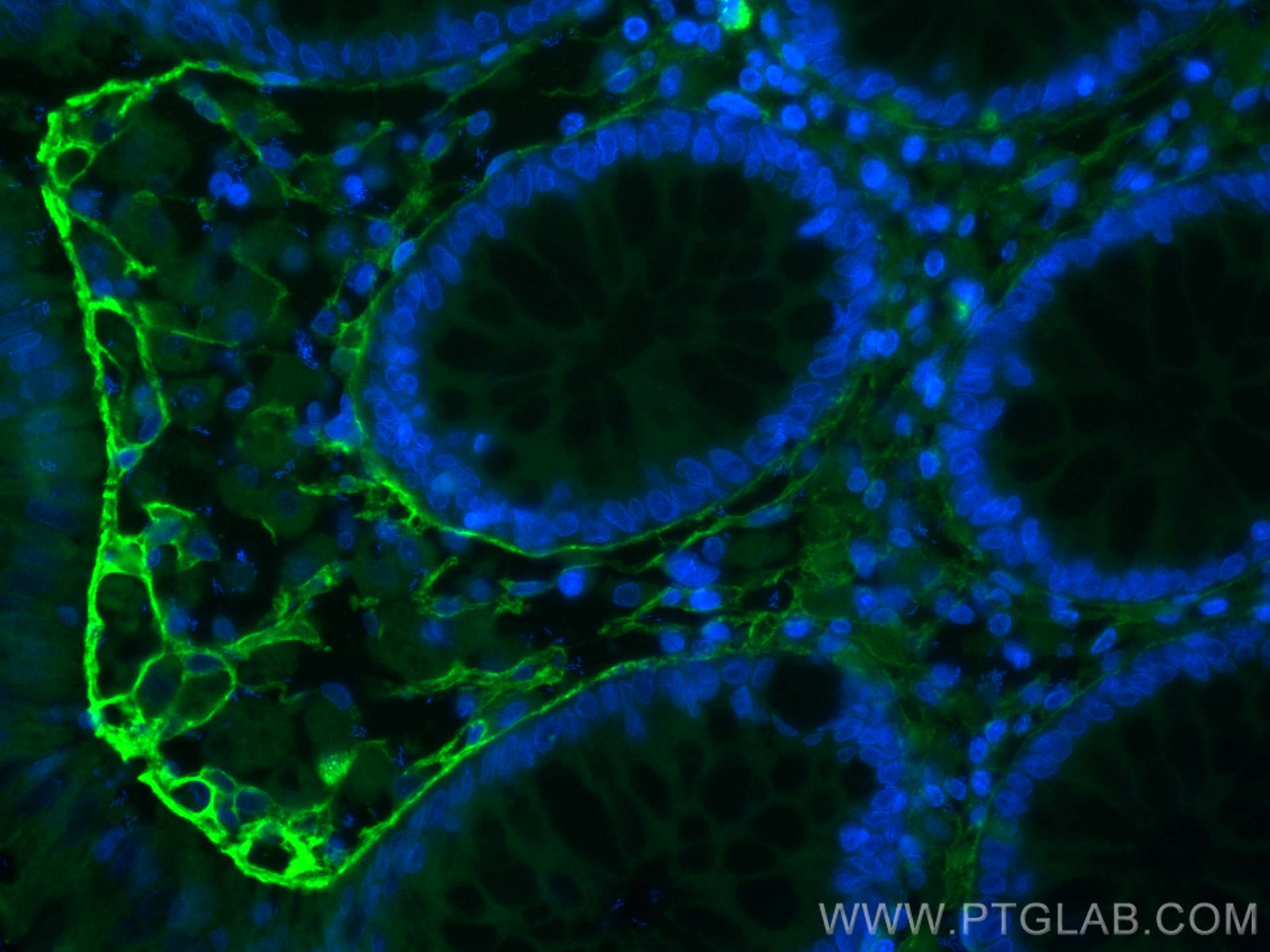 IF Staining of human colon using CL488-17023