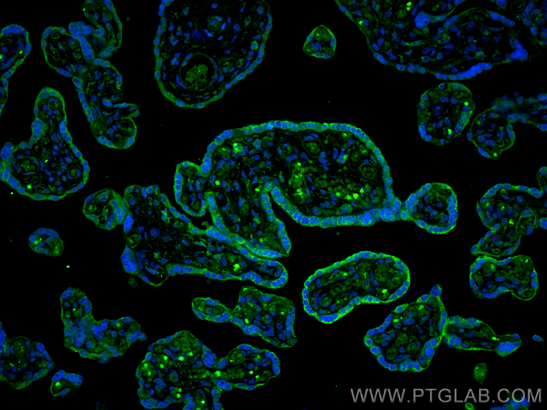 IF Staining of human placenta using 21841-1-AP