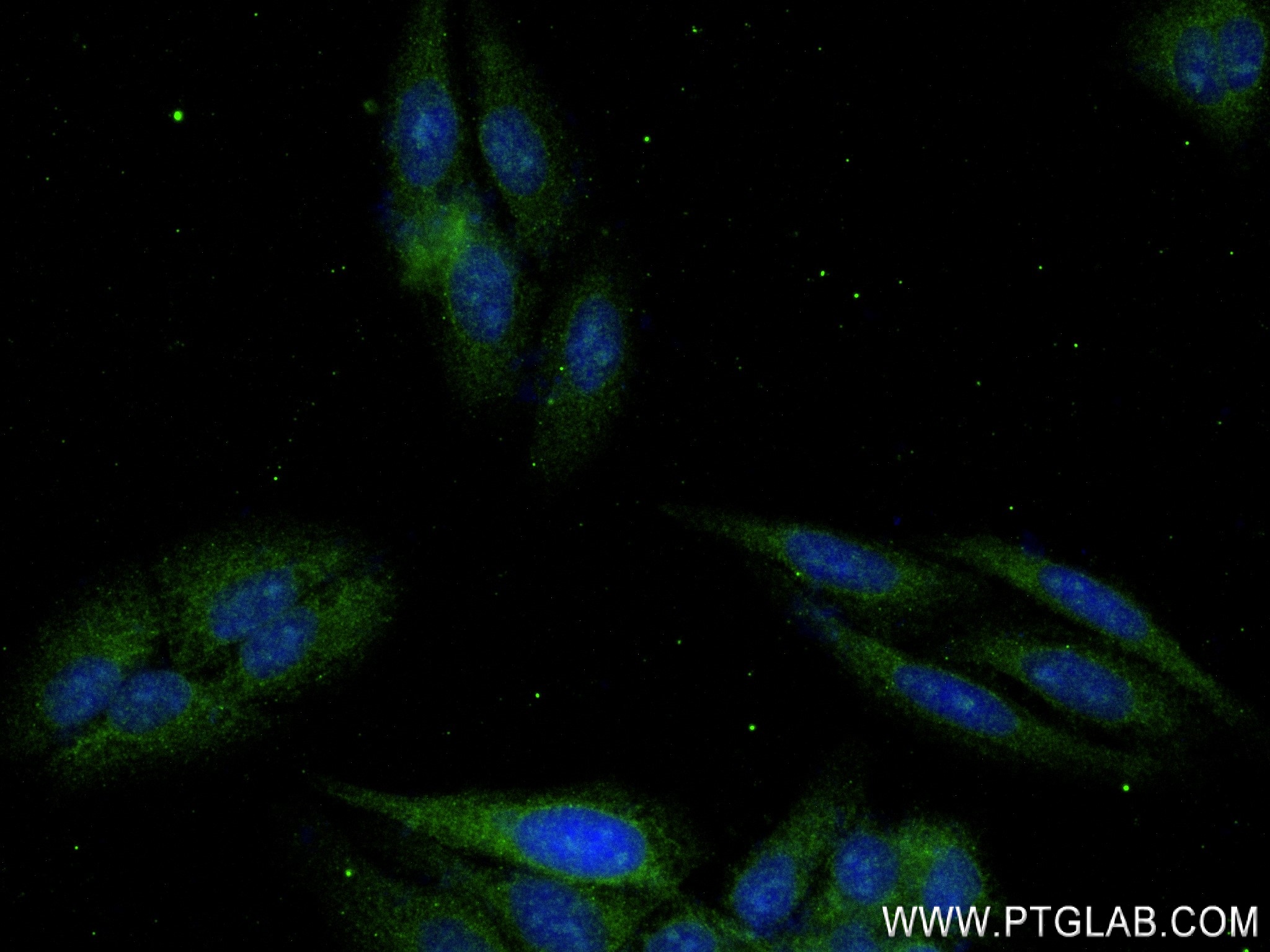 IF Staining of HepG2 using 84101-5-RR (same clone as 84101-5-PBS)