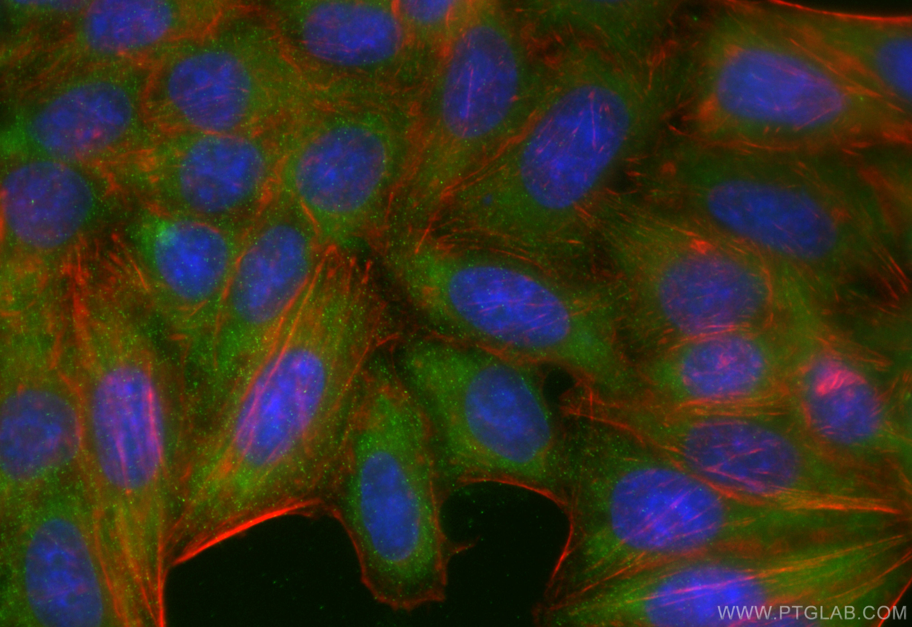 IF Staining of HepG2 using 84101-5-RR (same clone as 84101-5-PBS)