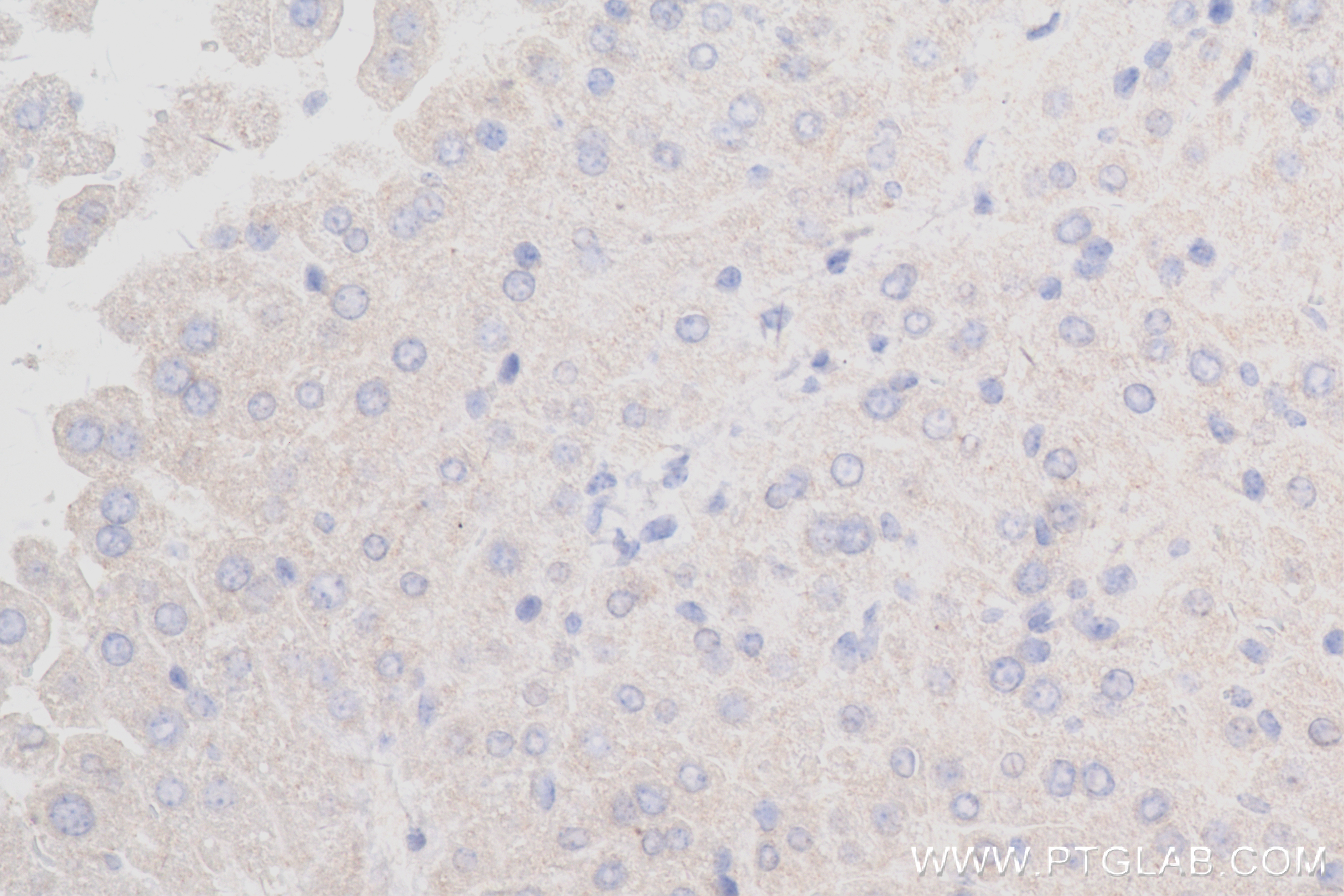 IHC staining of mouse liver using 84101-5-RR (same clone as 84101-5-PBS)