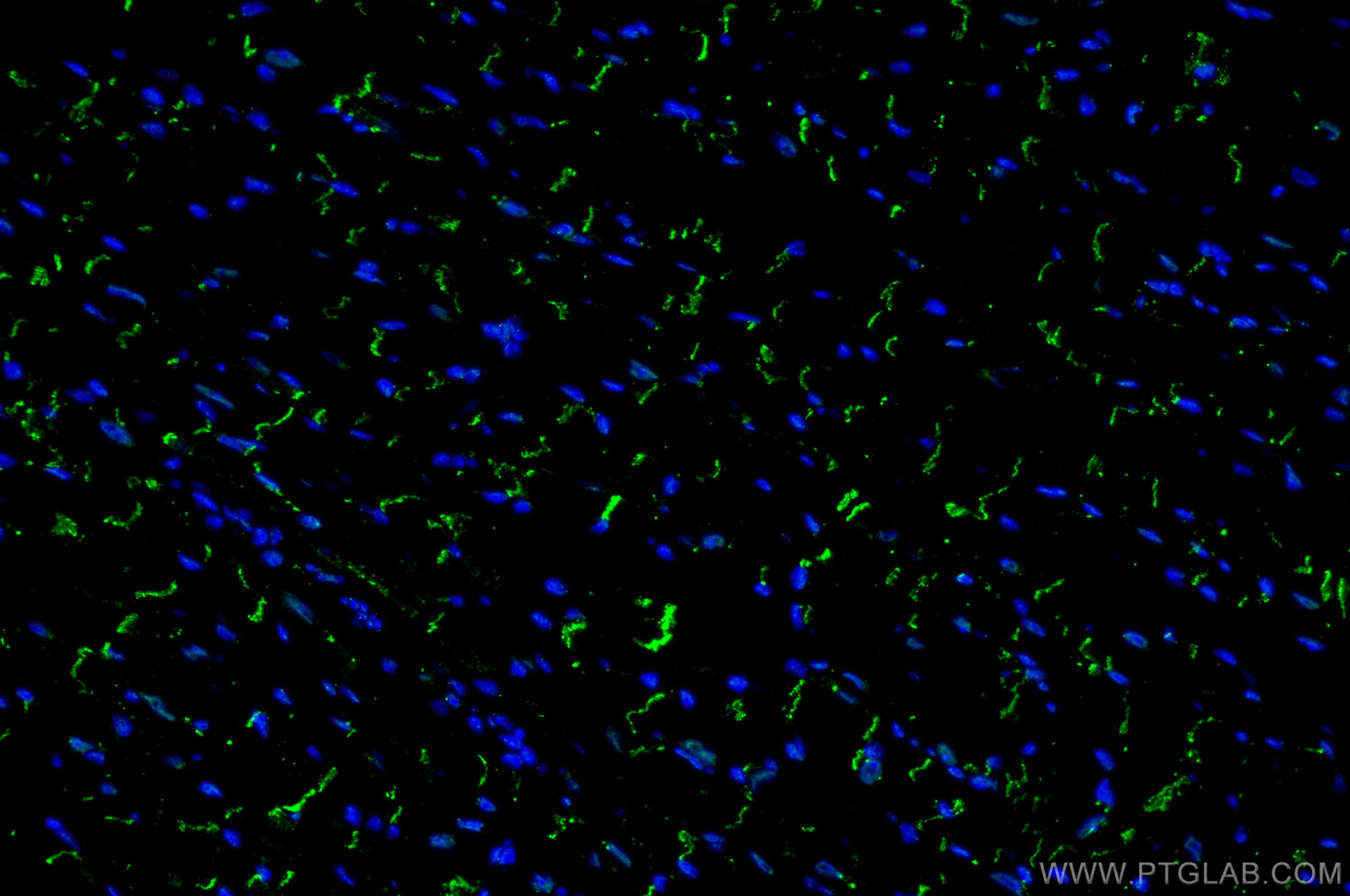 IF Staining of mouse heart using 26980-1-AP