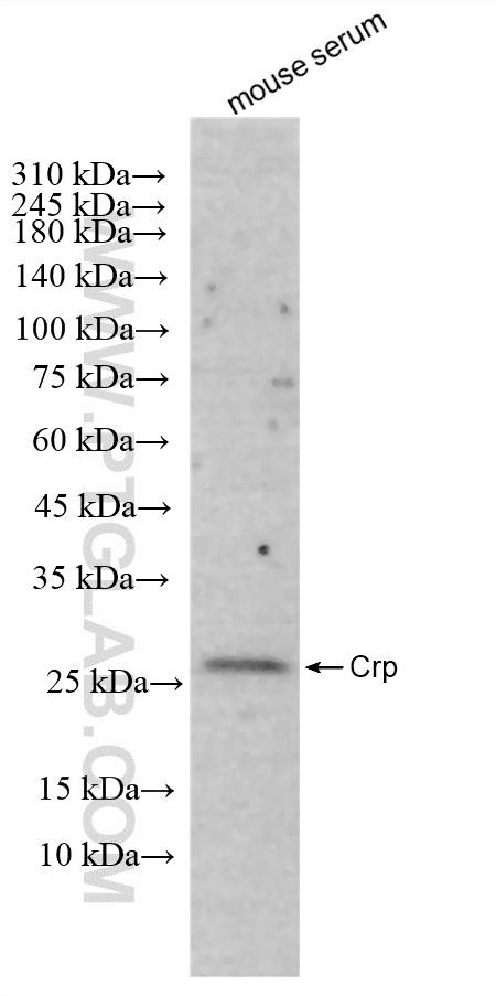 WB analysis of mouse serum using 83711-1-RR (same clone as 83711-1-PBS)