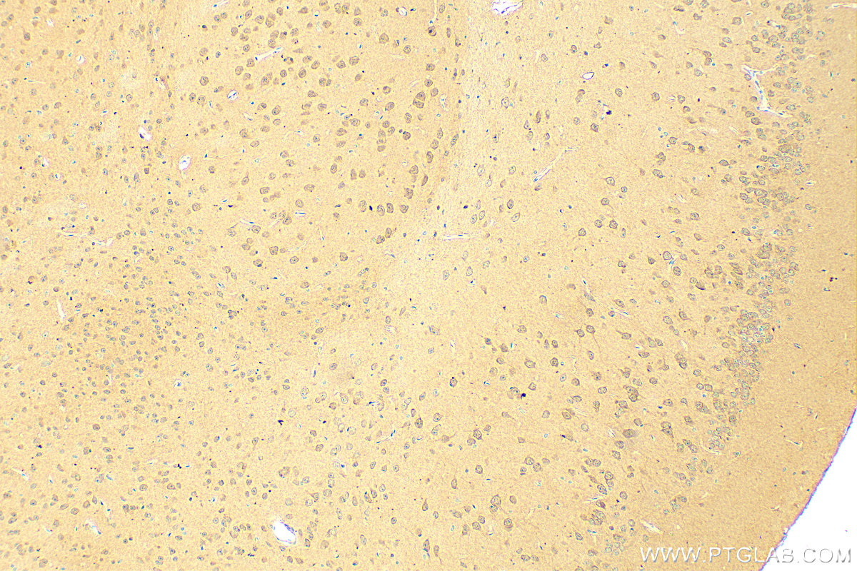 IHC staining of mouse brain using 31183-1-AP