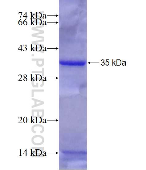 Cyclin E fusion protein Ag28418 SDS-PAGE