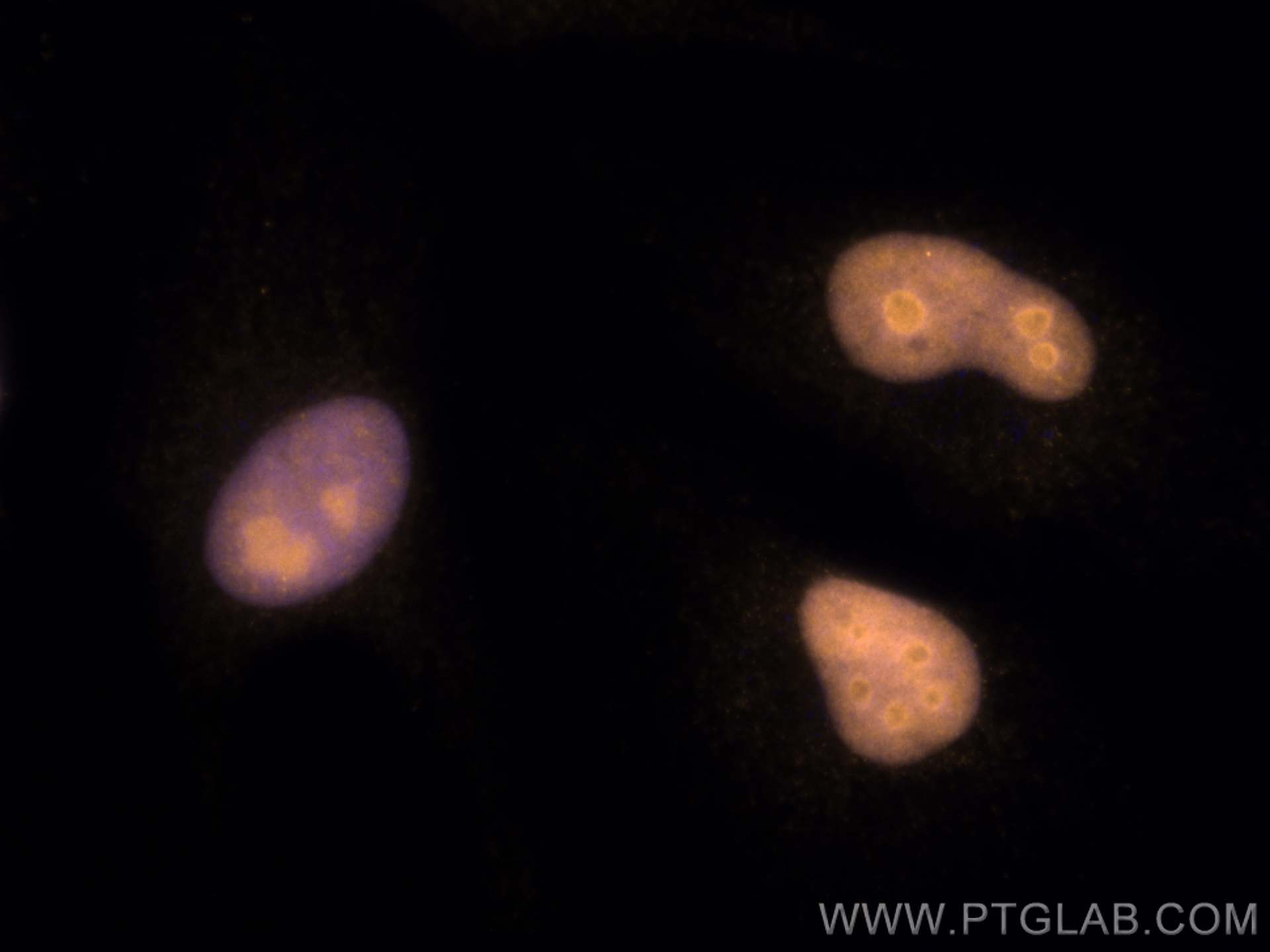 IF Staining of HeLa using CL555-11935