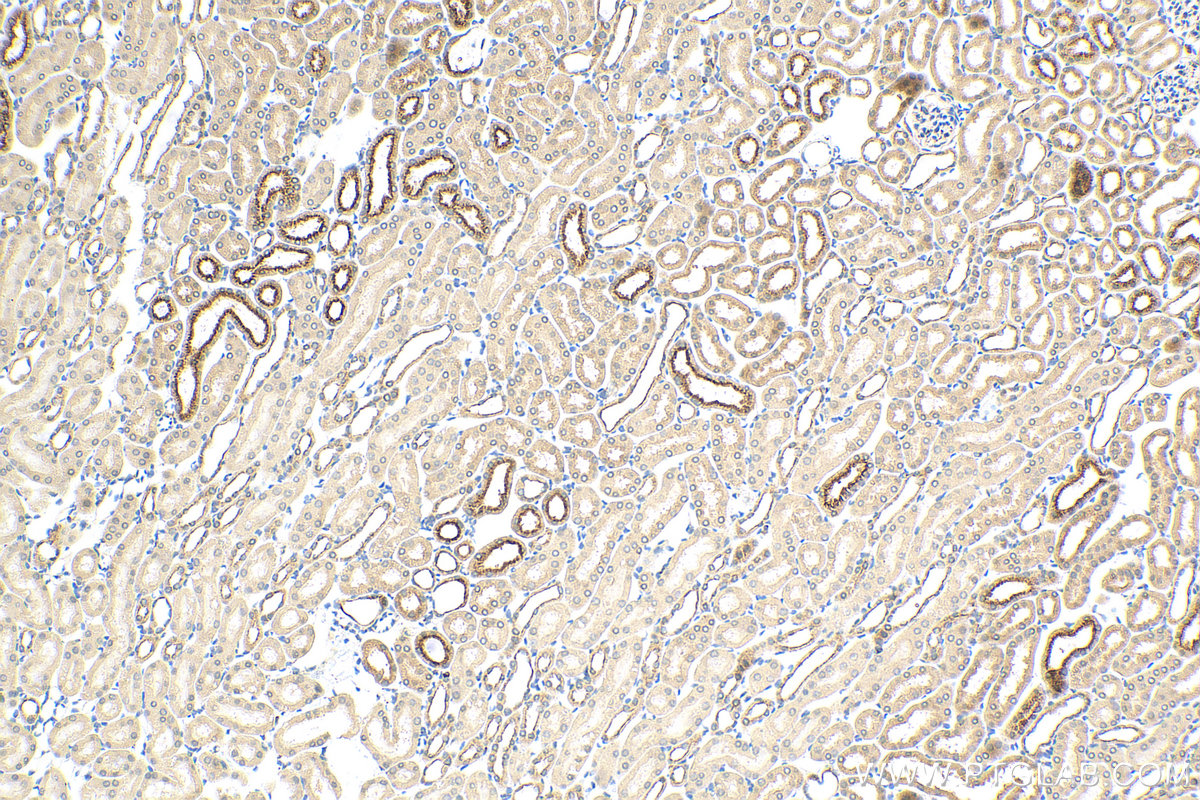 IHC staining of mouse kidney using 83422-1-RR