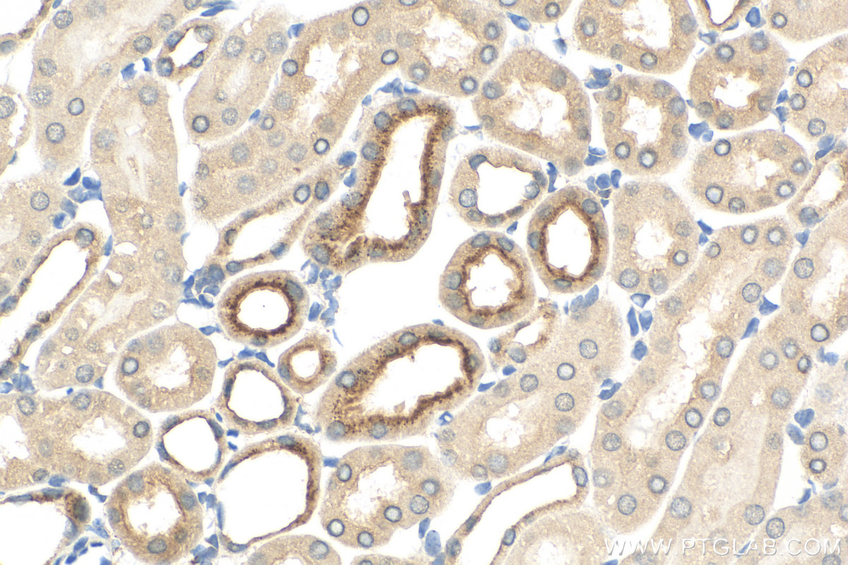 IHC staining of mouse kidney using 83422-1-RR (same clone as 83422-1-PBS)