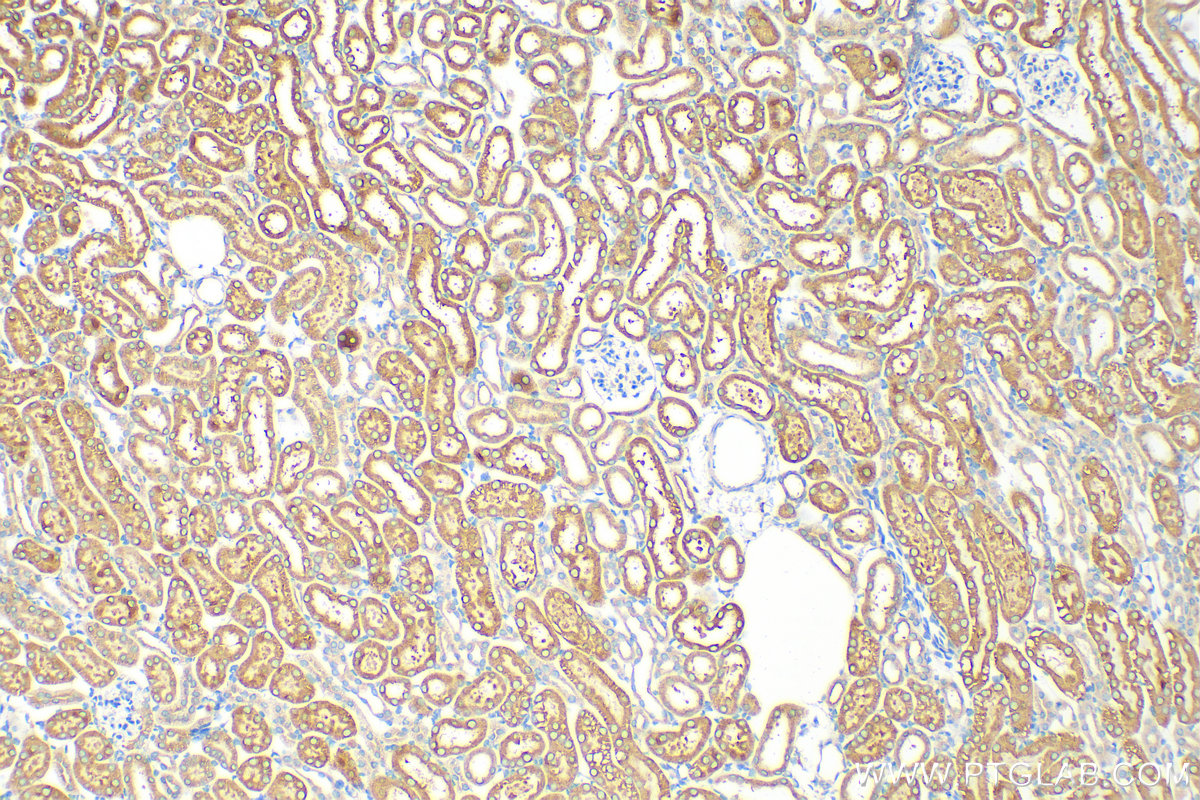 IHC staining of mouse kidney using 29814-1-AP