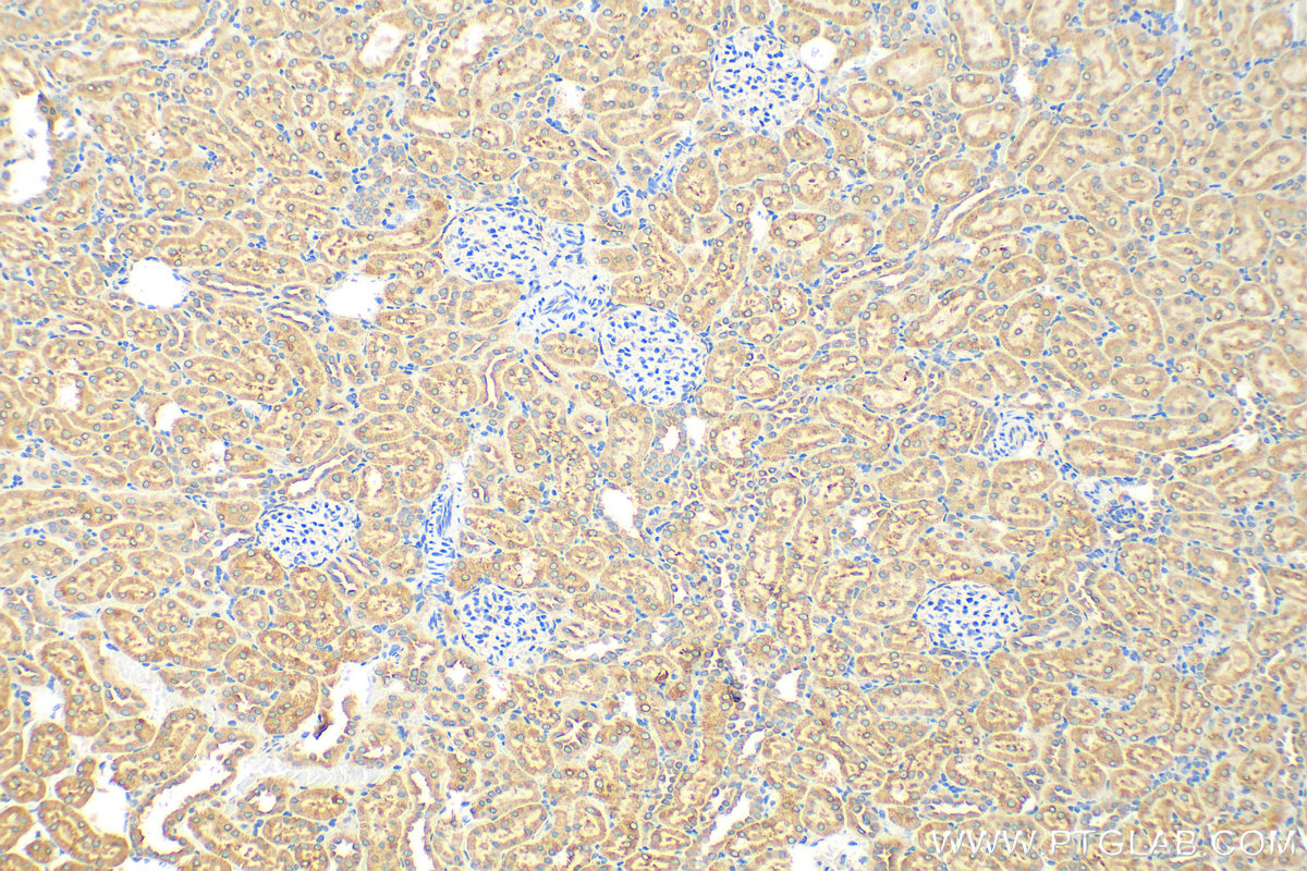 IHC staining of rat kidney using 29814-1-AP