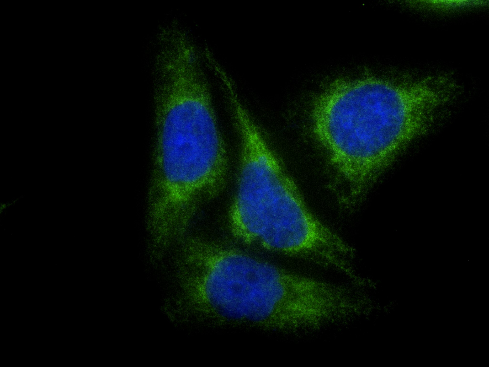 IF Staining of HepG2 using 83276-1-RR (same clone as 83276-1-PBS)