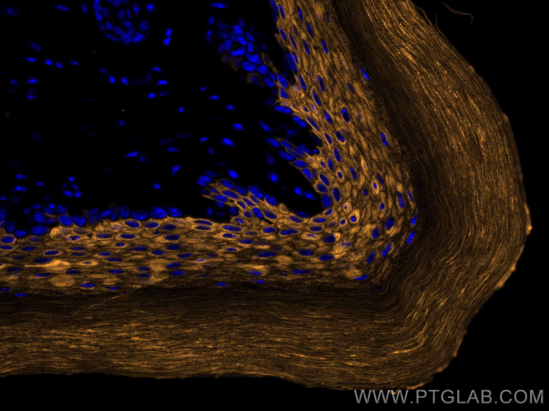 IF Staining of mouse skin using CL555-18343