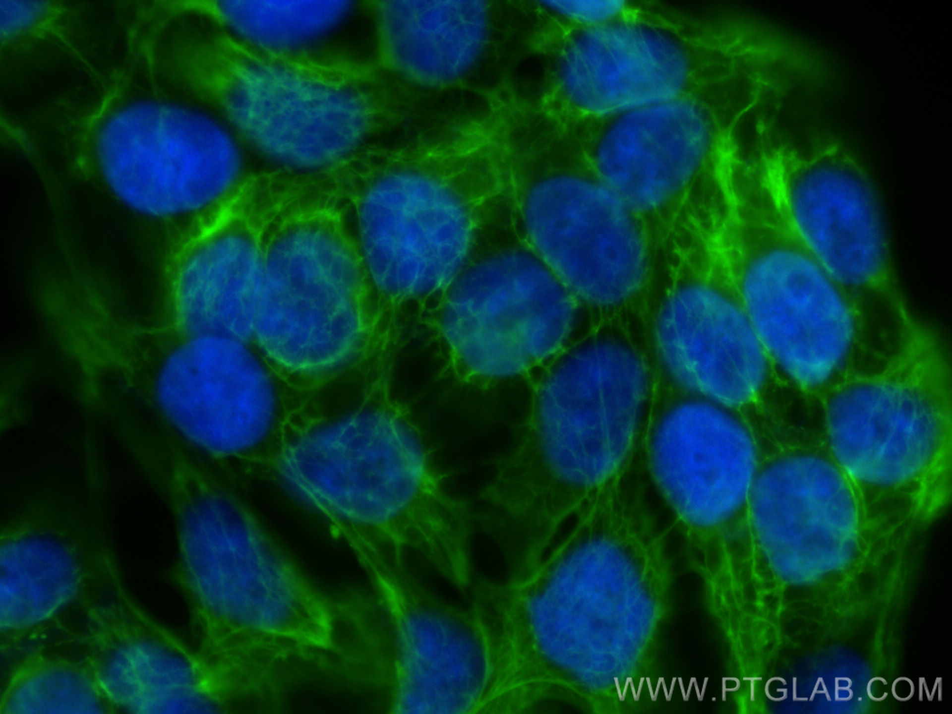 IF Staining of HaCaT using 83058-1-RR