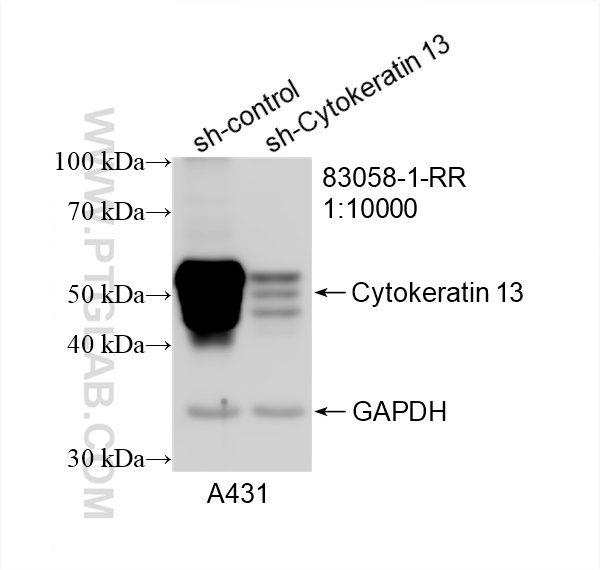 WB analysis of A431 using 83058-1-RR