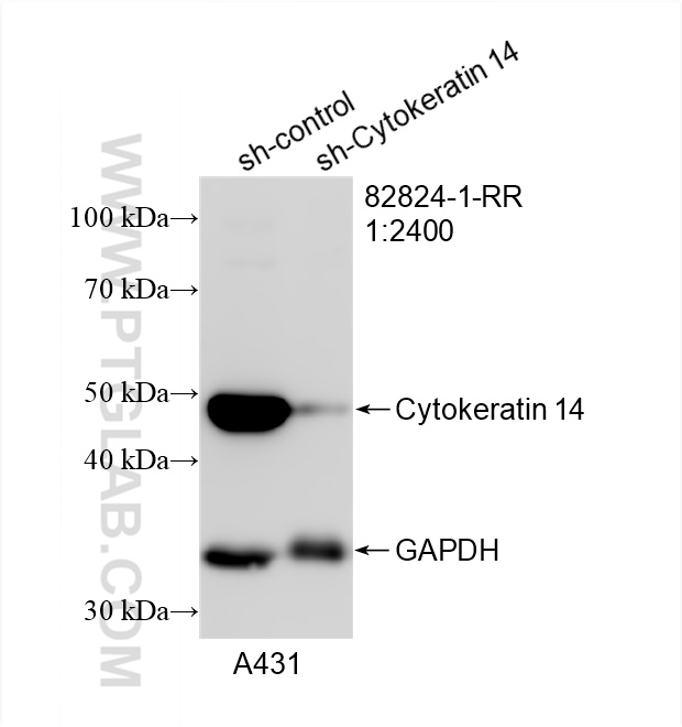 WB analysis of A431 using 82824-1-RR