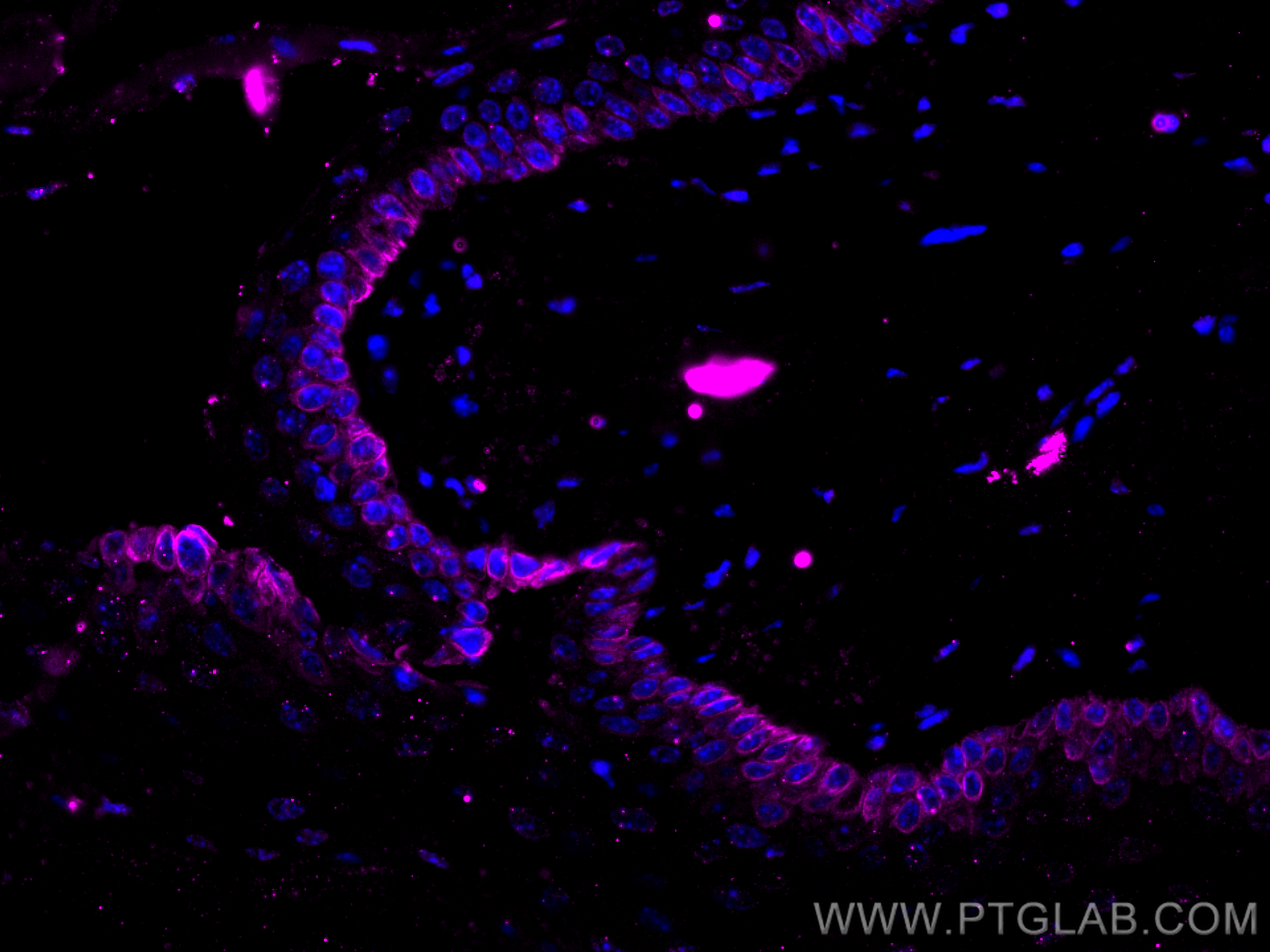 IF Staining of mouse skin using CL647-60320