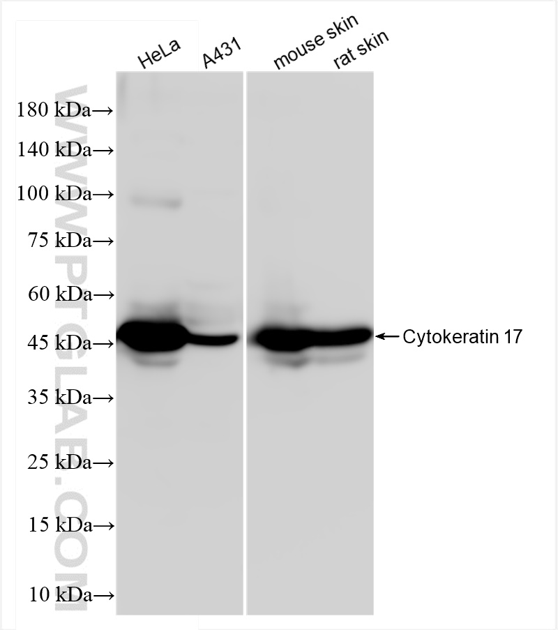 Cytokeratin 17-Specific