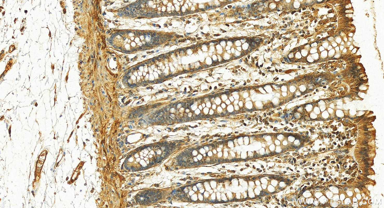 IHC staining of human normal colon using 29855-1-AP