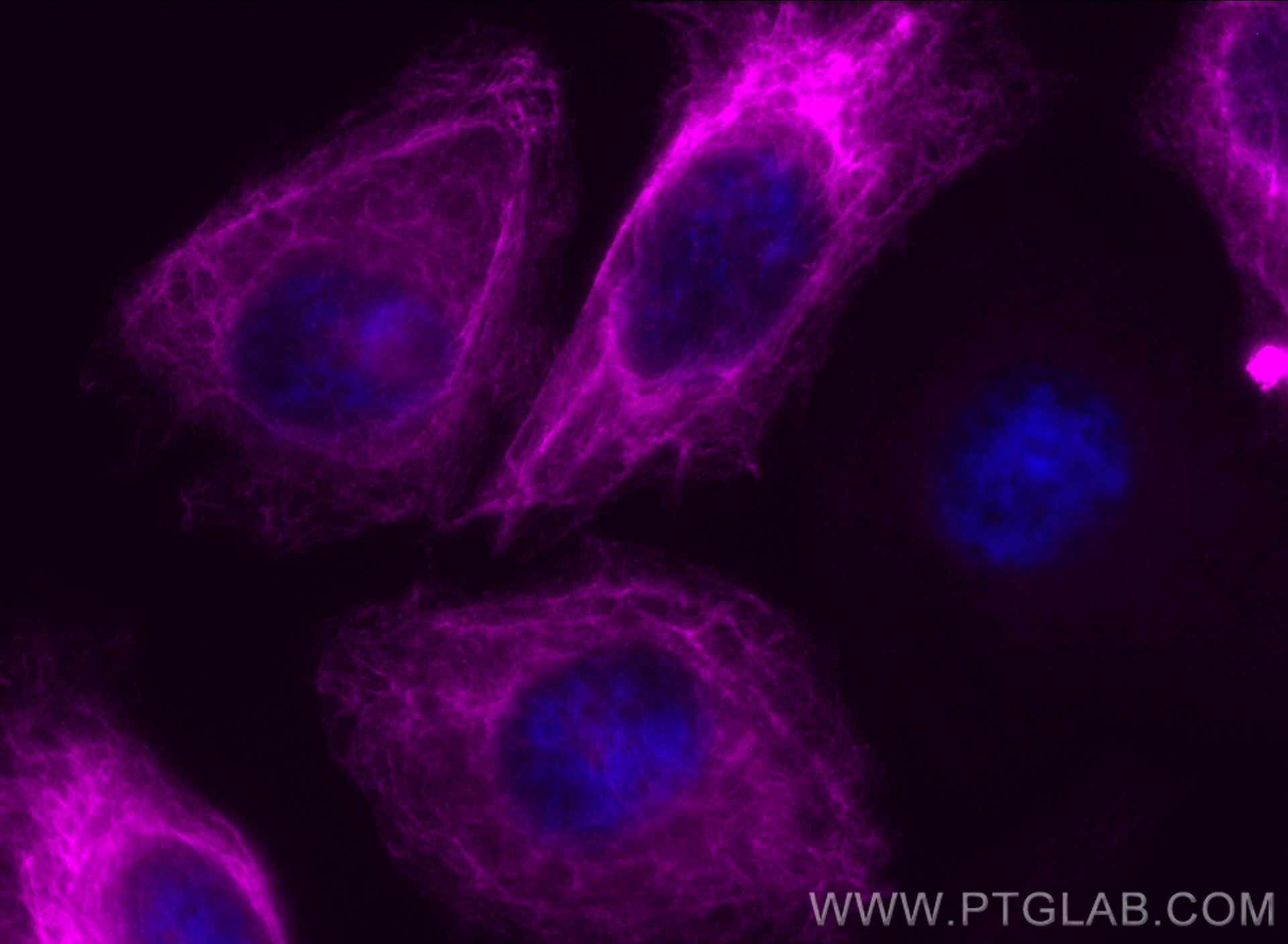 IF Staining of HeLa using CL647-14965