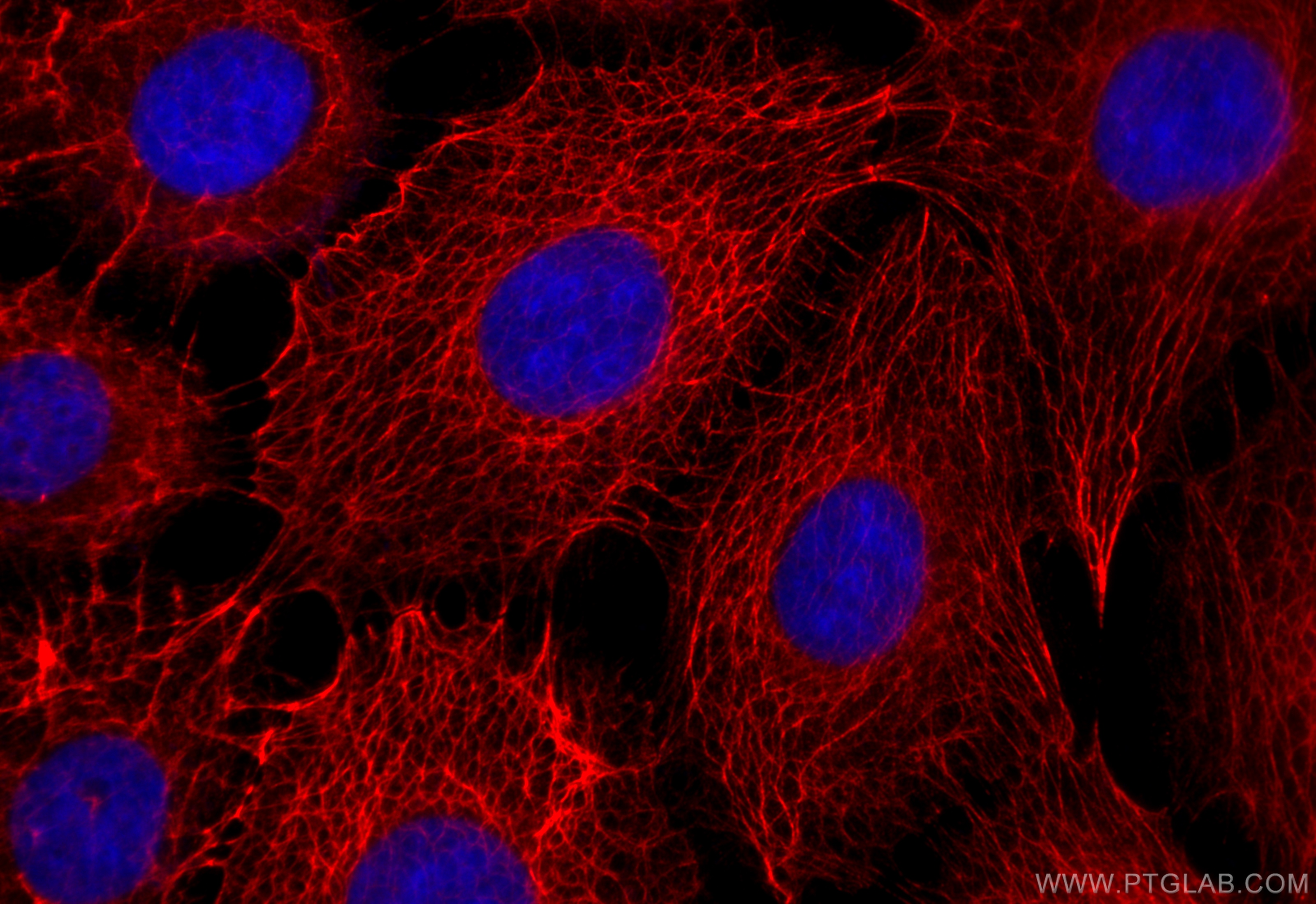 IF Staining of A431 using CL594-28506