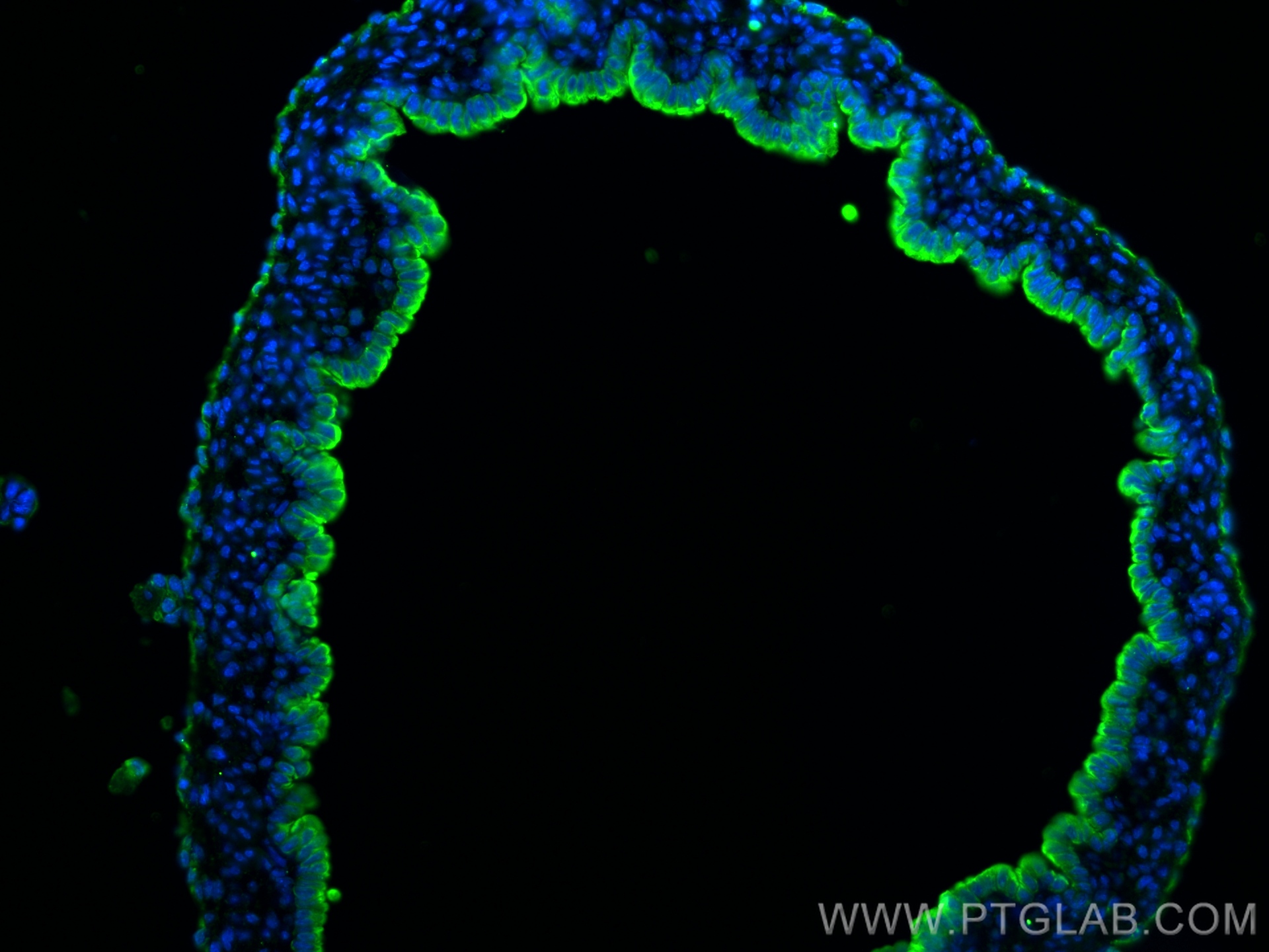 IF Staining of mouse liver using 68296-1-Ig (same clone as 68296-1-PBS)