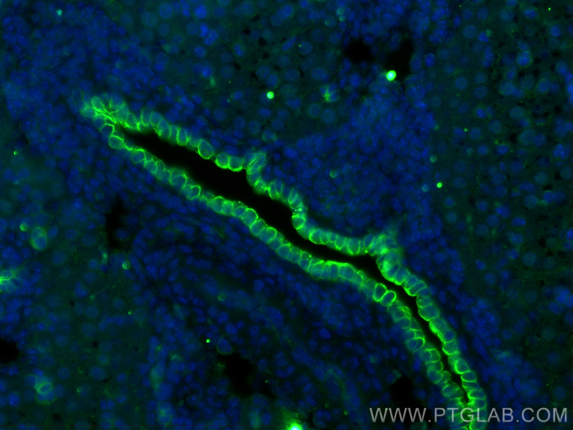 IF Staining of mouse liver using 68296-1-Ig (same clone as 68296-1-PBS)