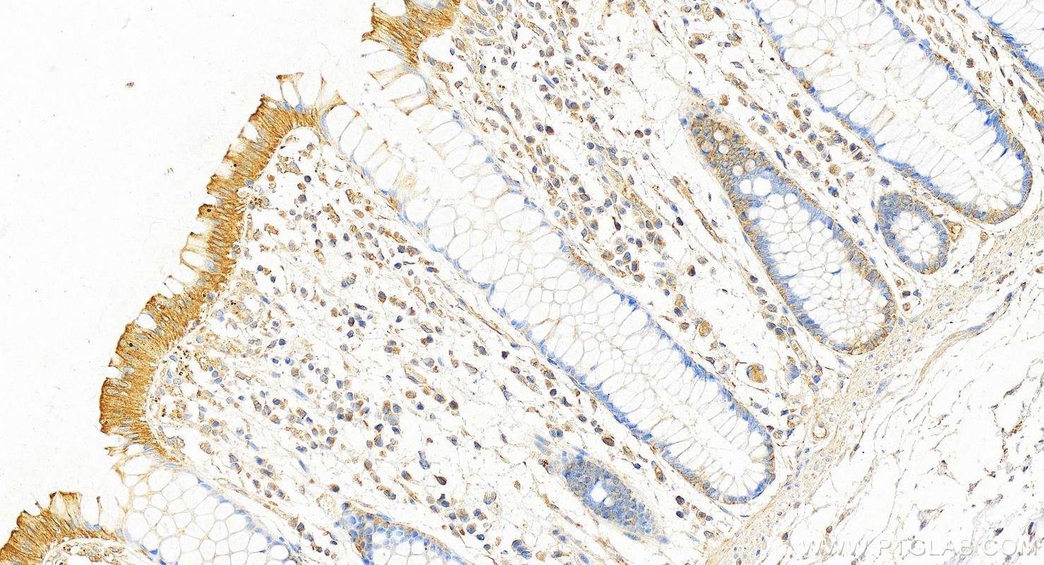 IHC staining of human colon using 68627-1-Ig (same clone as 68627-1-PBS)