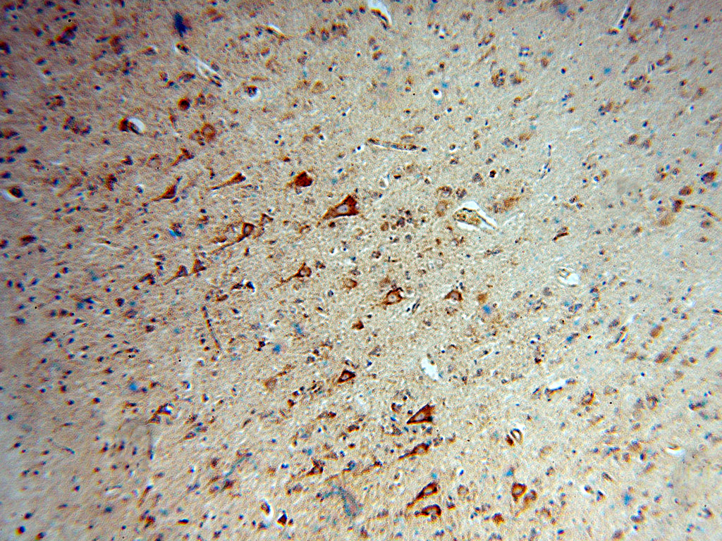 IHC staining of human brain using 14876-1-AP