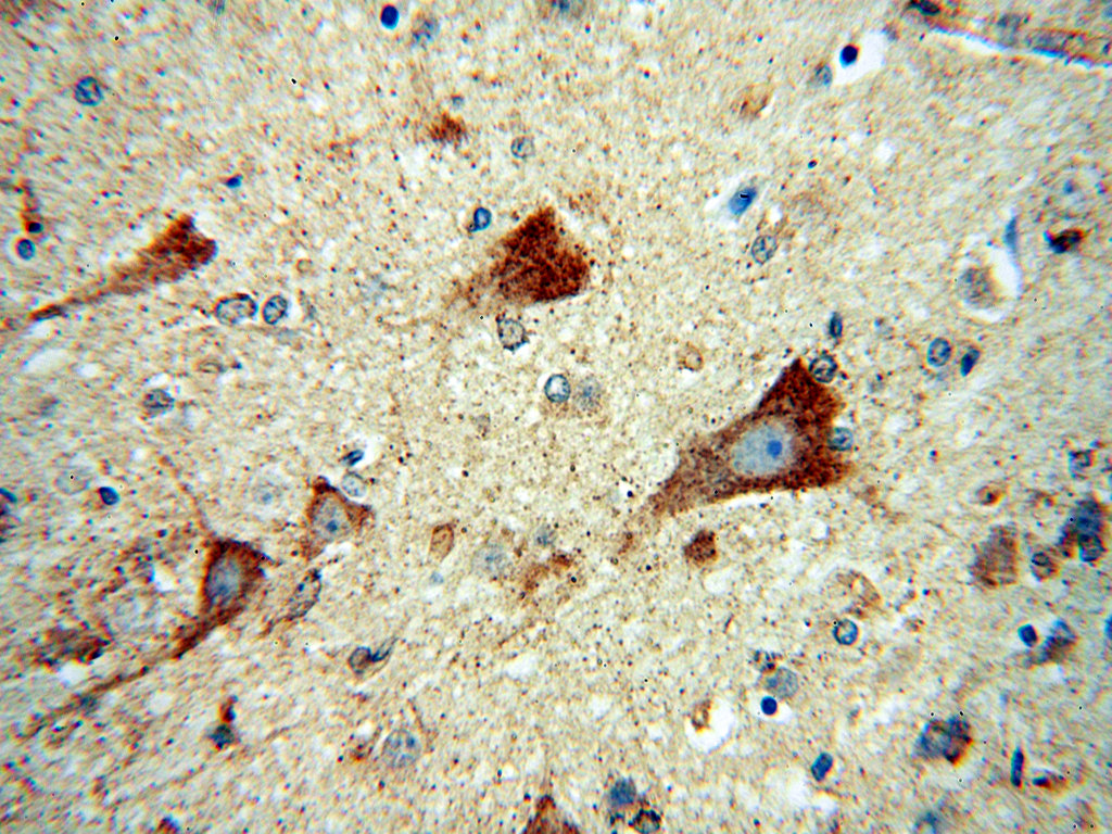 IHC staining of human brain using 14876-1-AP