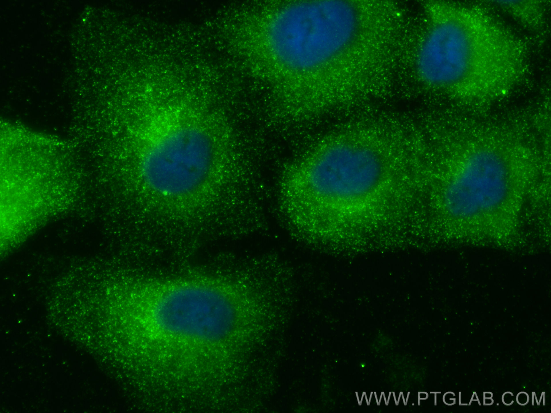 IF Staining of A549 using 66735-1-Ig (same clone as 66735-1-PBS)